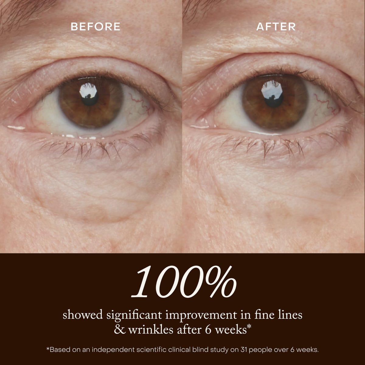 True Botanicals Resurrection Radiance Eye Cream for Dark - True Botanicals Official Imagery - 5