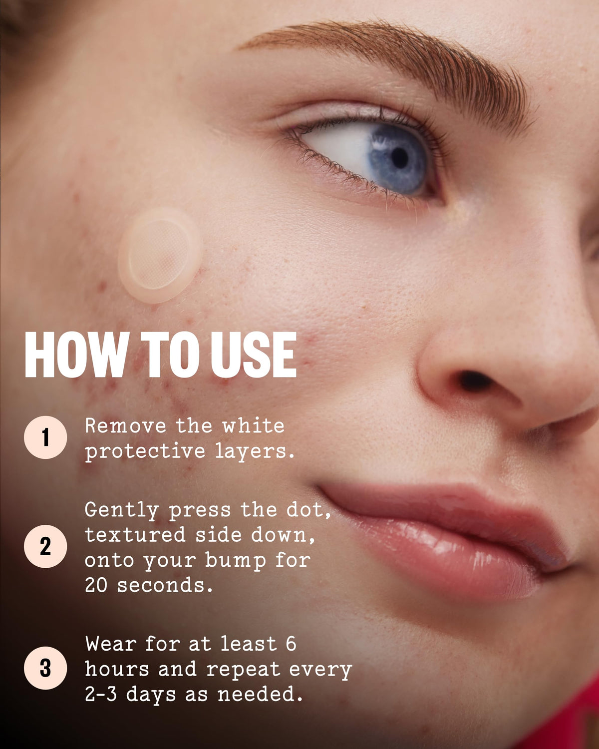 PEACE OUT Early Stage Acne Microneedling Hydrocolloid Dots - PEACE OUT Official Imagery - 8
