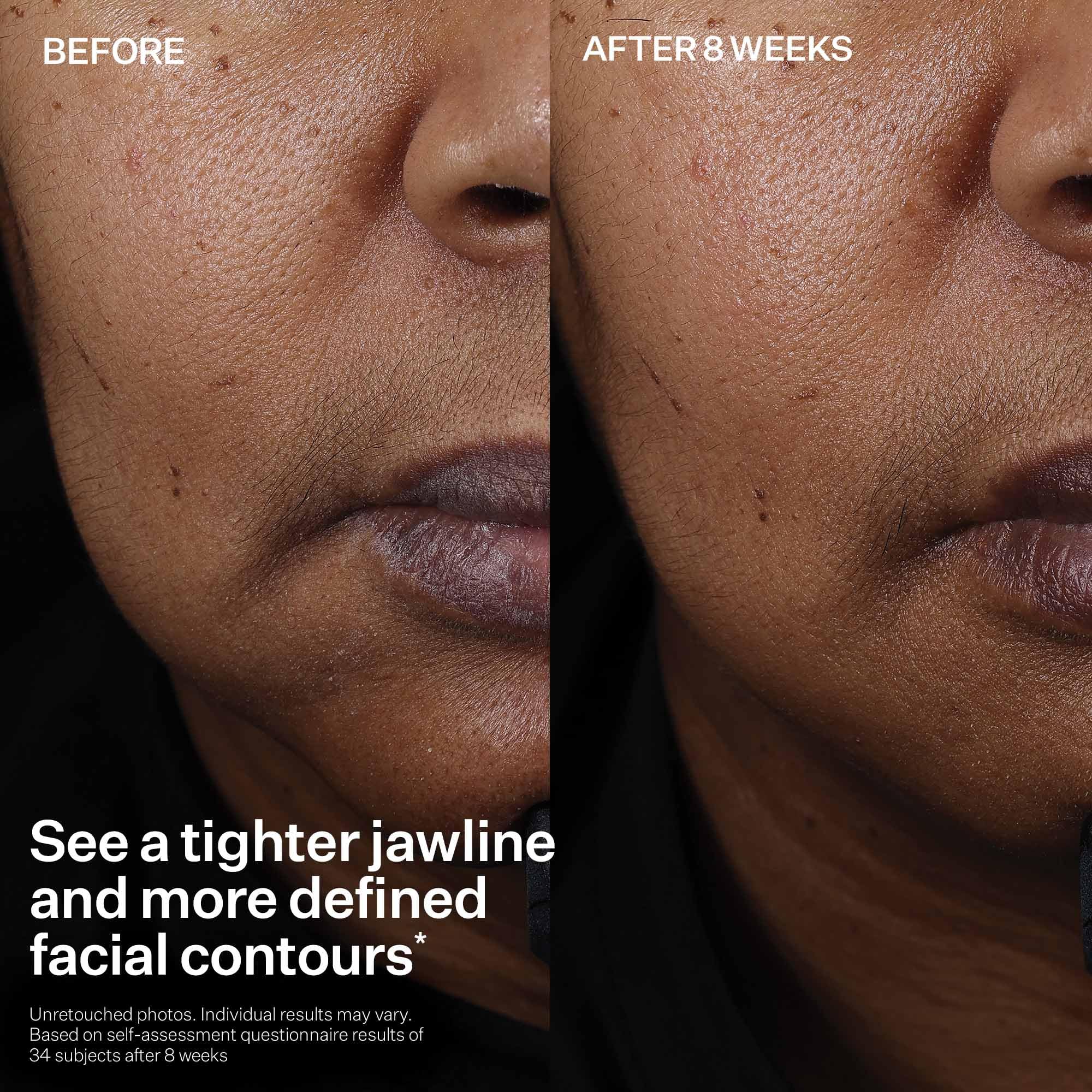 StriVectin Tighten & Lift Peptight Face Lift Serum with Tightening & Brightening Peptides for Wrinkles - Elefair Tech Official Product View 7