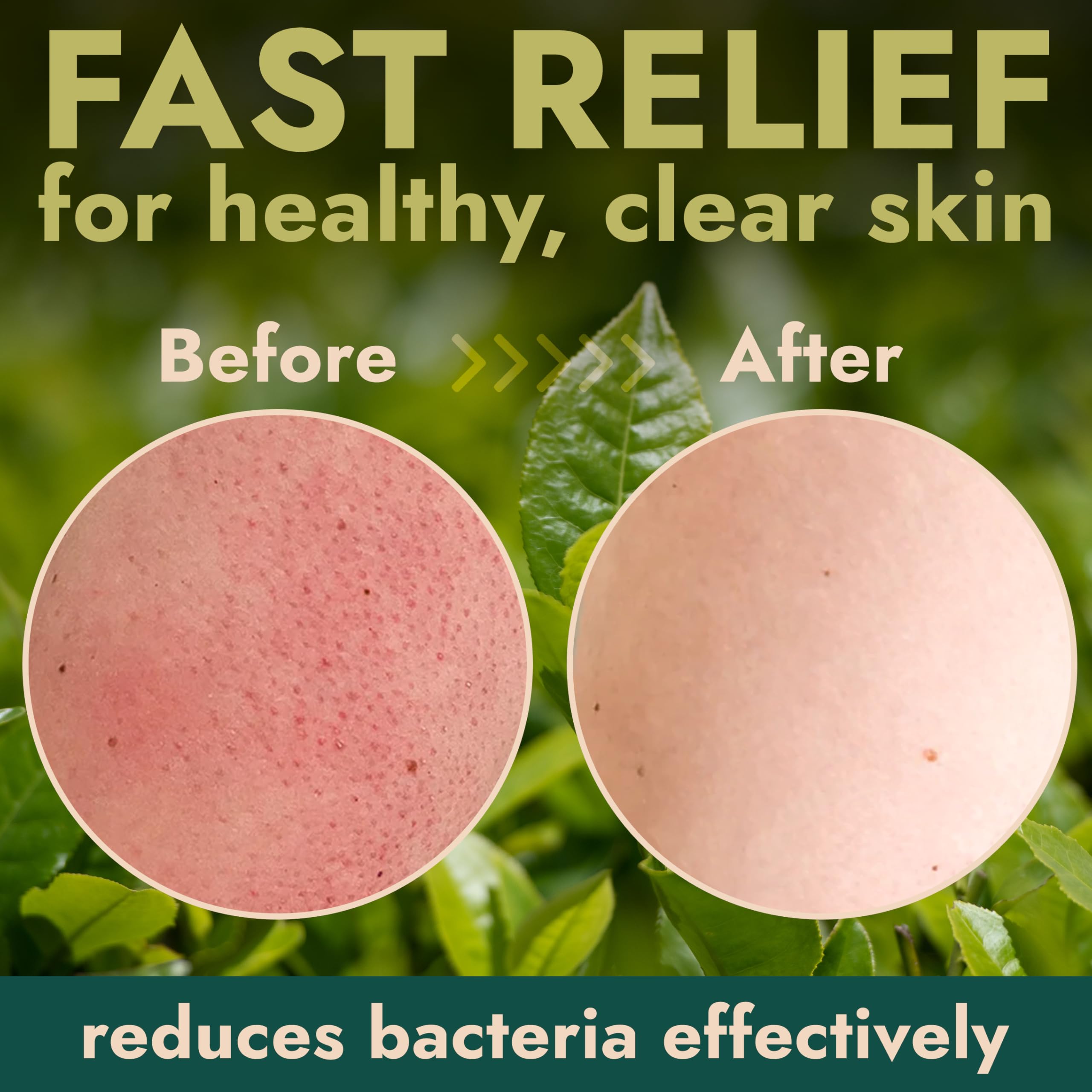 Terramed Just Think Comfort Antibacterial Body Scrub Exfoliator Deep Cleansing - Terramed Just Think Comfort Official Product View 6