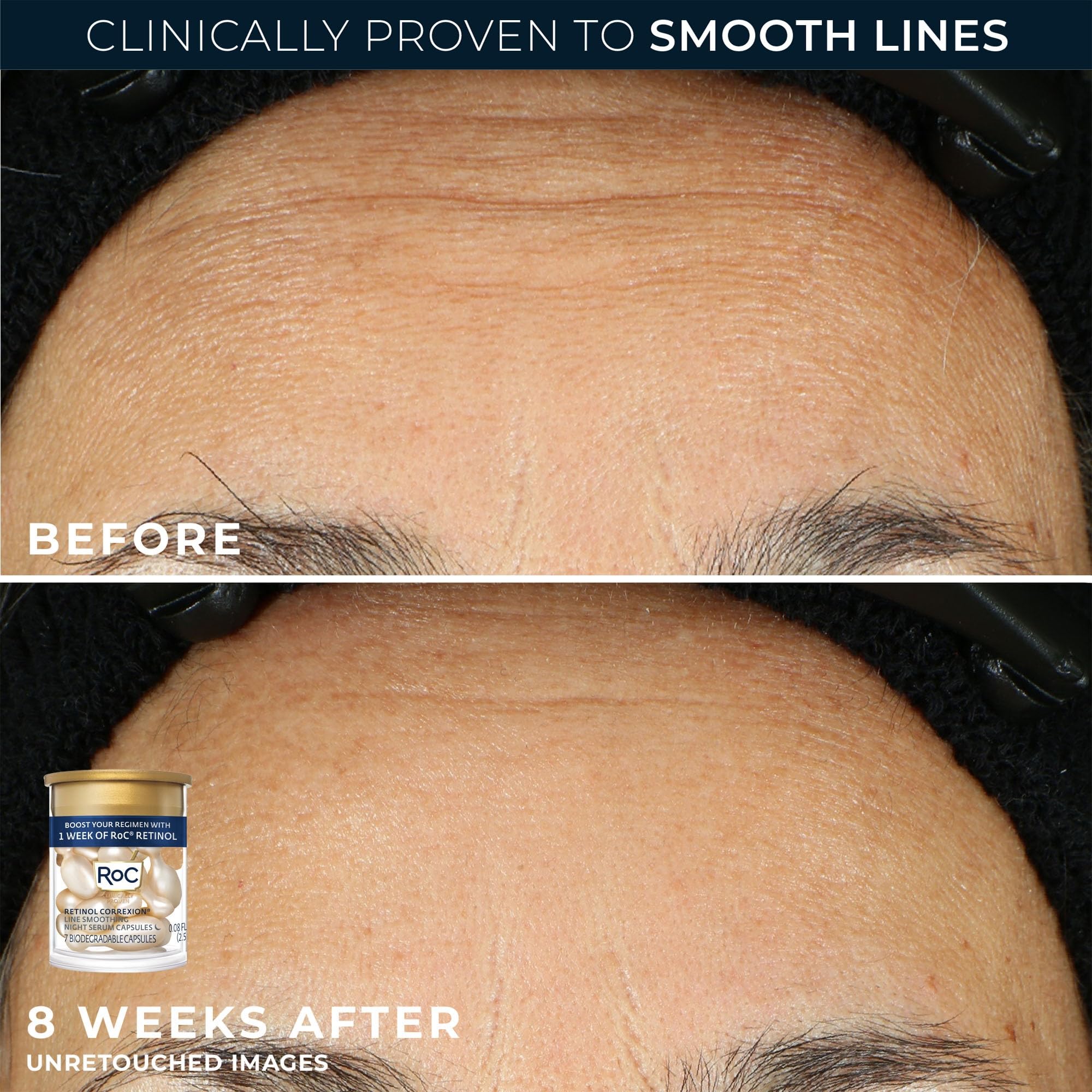 RoC Clinical Mini Retinol Anti Aging Skincare Routine Kit - RoC Official Imagery - 7