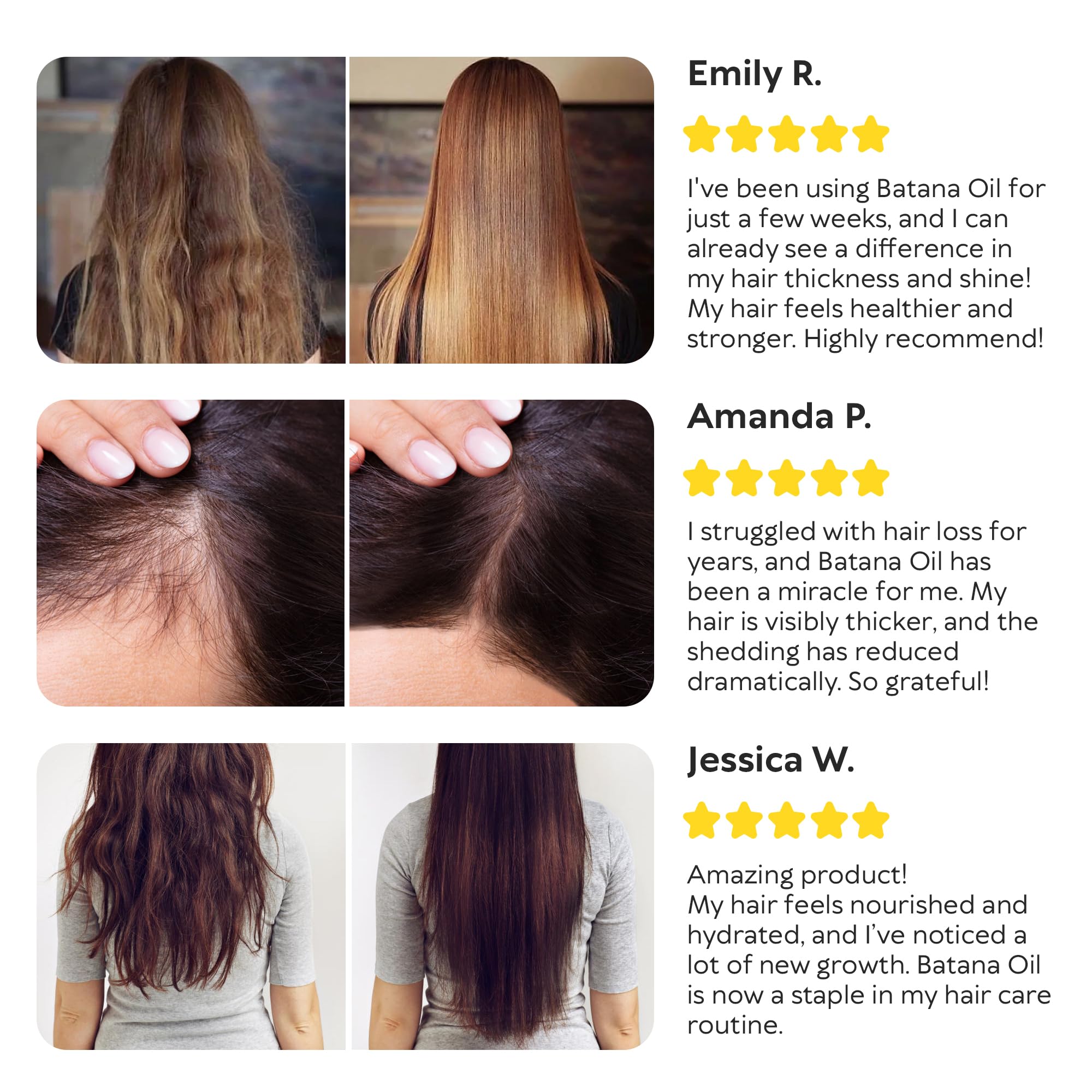 RICHGRAND Batana Oil for Hair Growth - 100% Raw & Organic Unrefined Batana Oi - RICHGRAND Official Product View 9