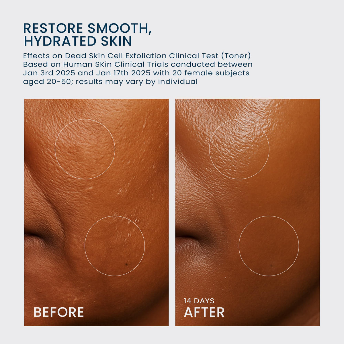 NIACINDY Glow Reset Toner Volume UP Serum Set for Daily - mimmua! Official Imagery - 3