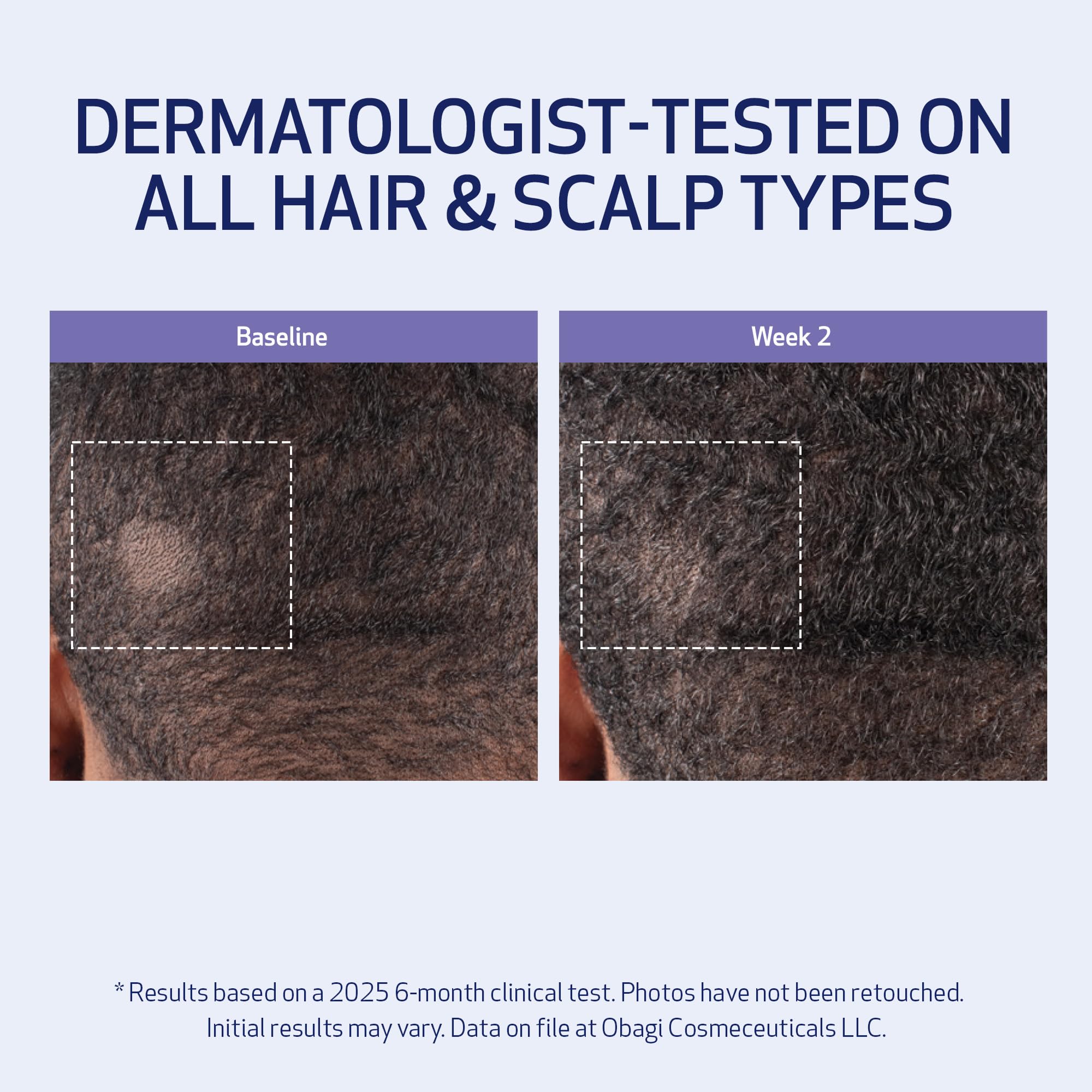Obagi Nu Cil BioStim Hair Scalp Serum with Biotin - Elefair Store Official Product Imagery - 5