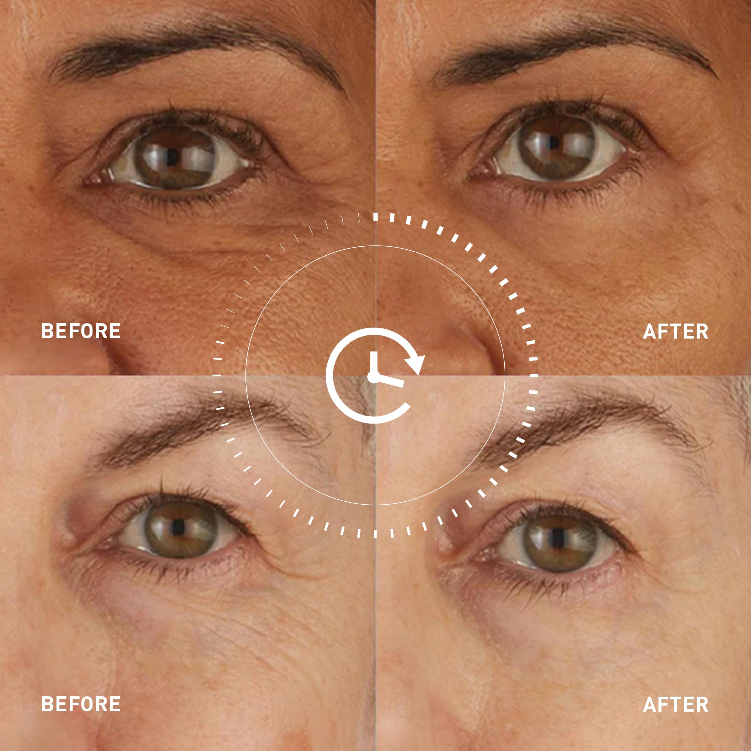 Skyn ICELAND Hydro Cool Firming Eye Patches with Peptides - skyn ICELAND Official Imagery - 7