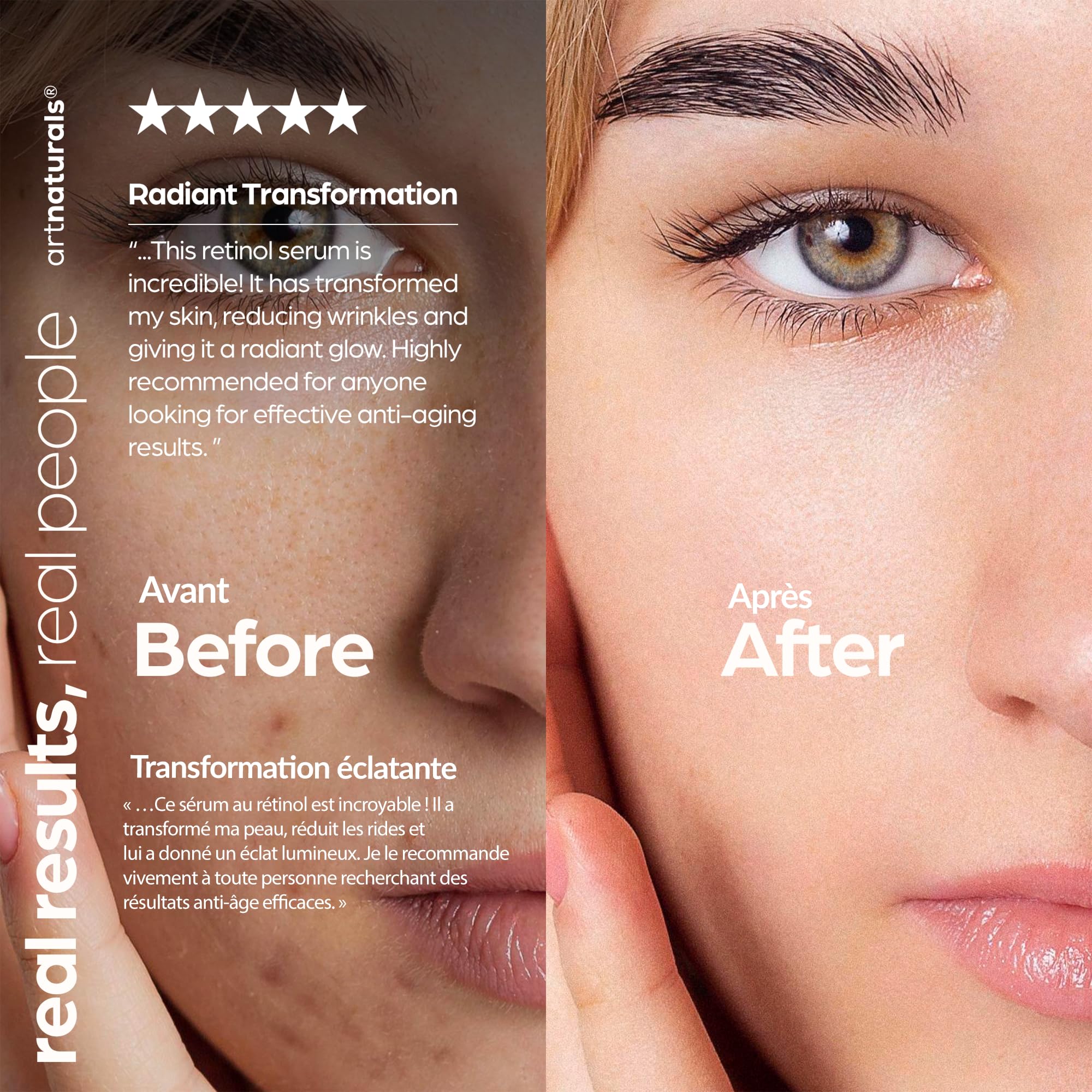 ArtNaturals Retinol Face Serum, 1 fl oz - Artnaturals Official Product View 9