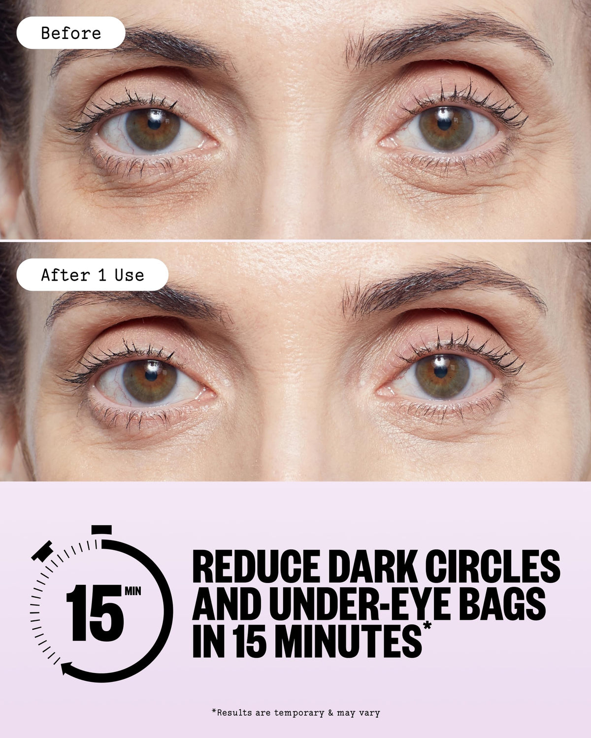 PEACE OUT Puffy Eyes Hydrating Under Eye Patches masks, showing soothing gel patches applied under eyes for hydration and refreshment.
