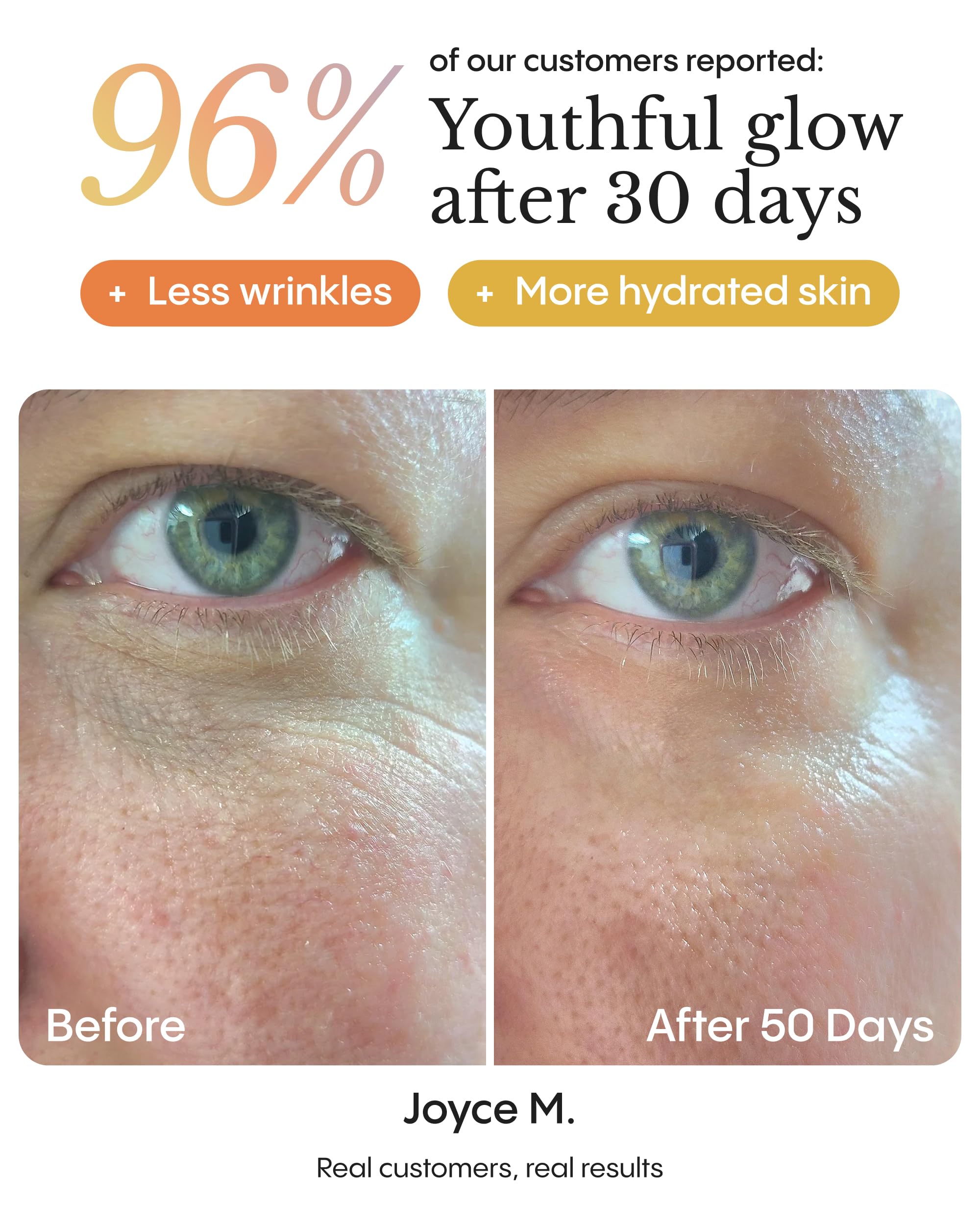 FRØYA Organics Hyper Potent Dark Circles & Bag Eye Balm (0.5 oz) - FRØYA Official Product View 6