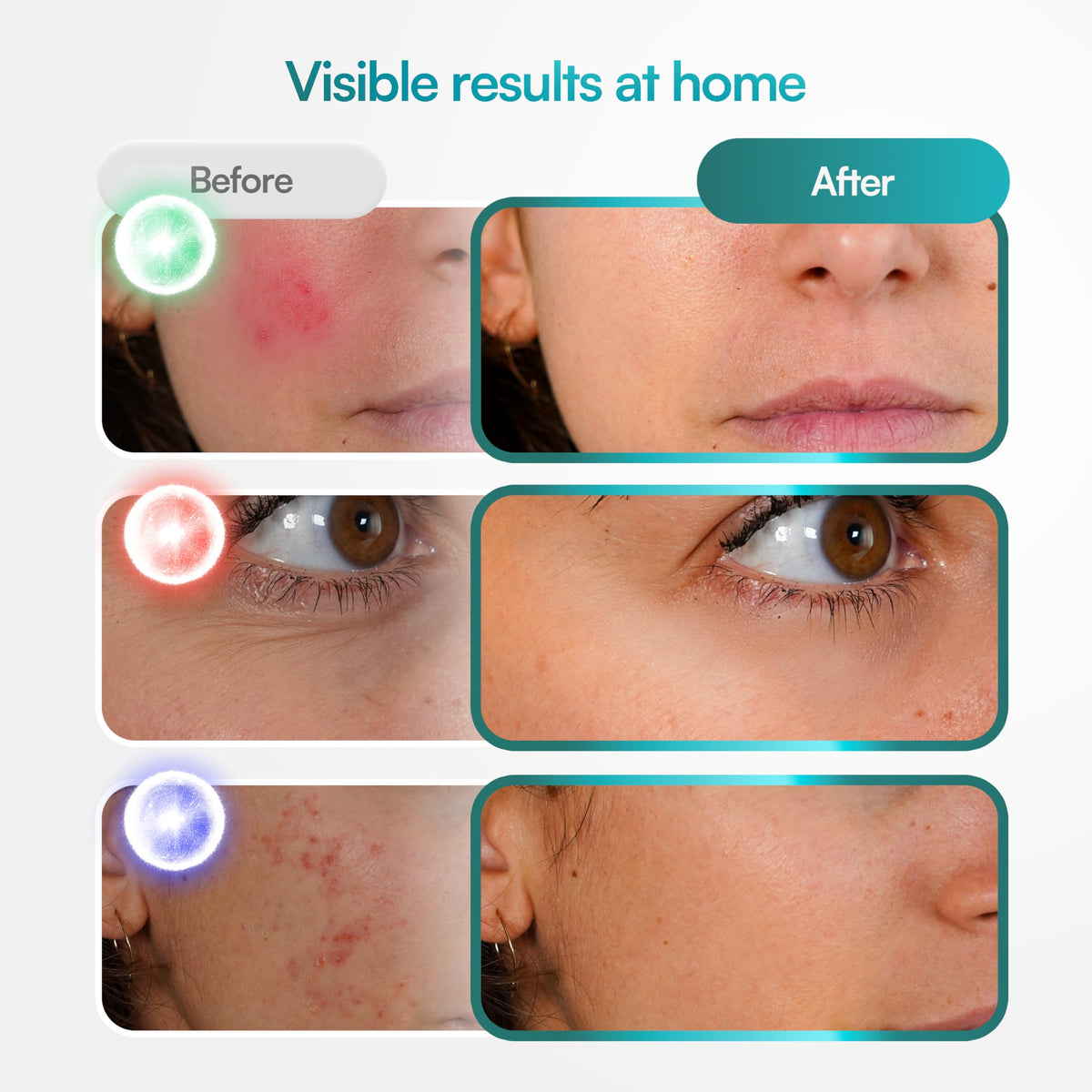 Red Light Therapy for Face Wireless LED Face Mask Light - BluMora Official Imagery - 5