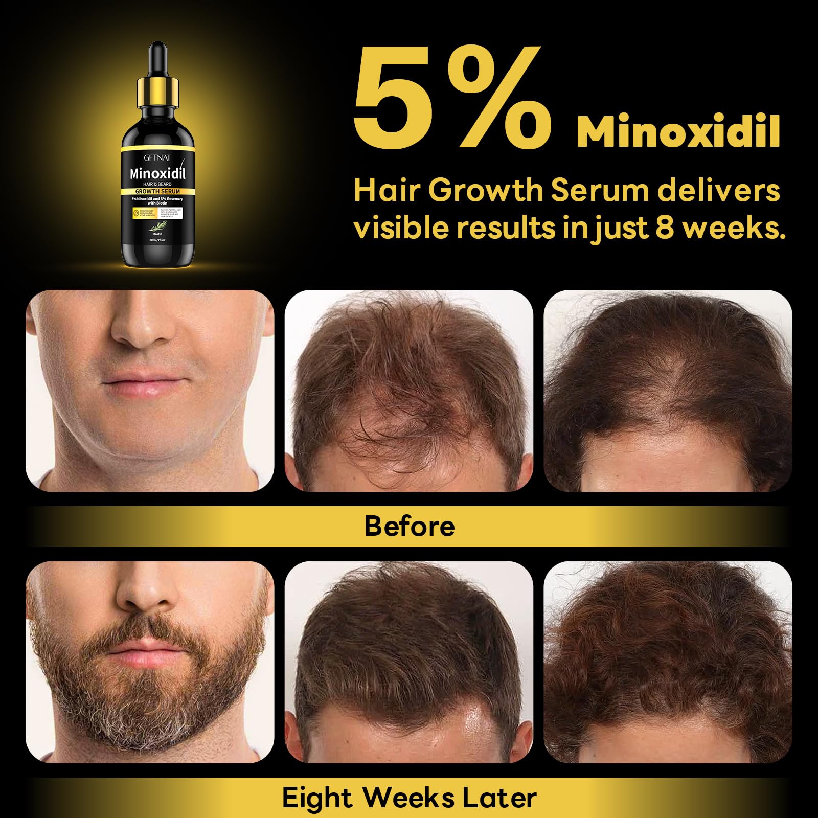 andelusita 5% Minoxidil Hair Growth Serum with Biotin & Rosemary - Extra - andelusita Official Product View 5