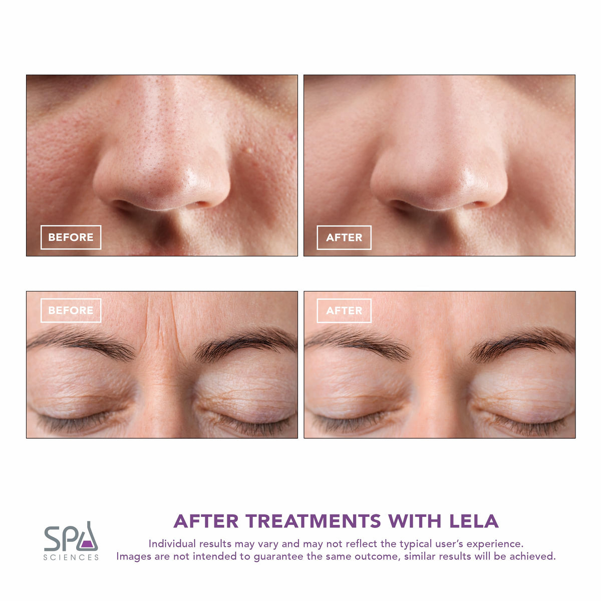Spa Sciences - SPA SCIENCES Official Imagery - 5