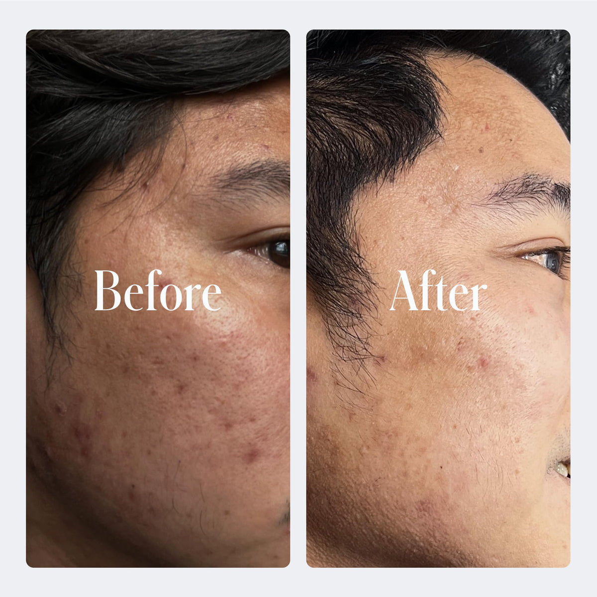 Geologie Retinol Anti Aging Face Cream - Geologie Official Imagery - 7
