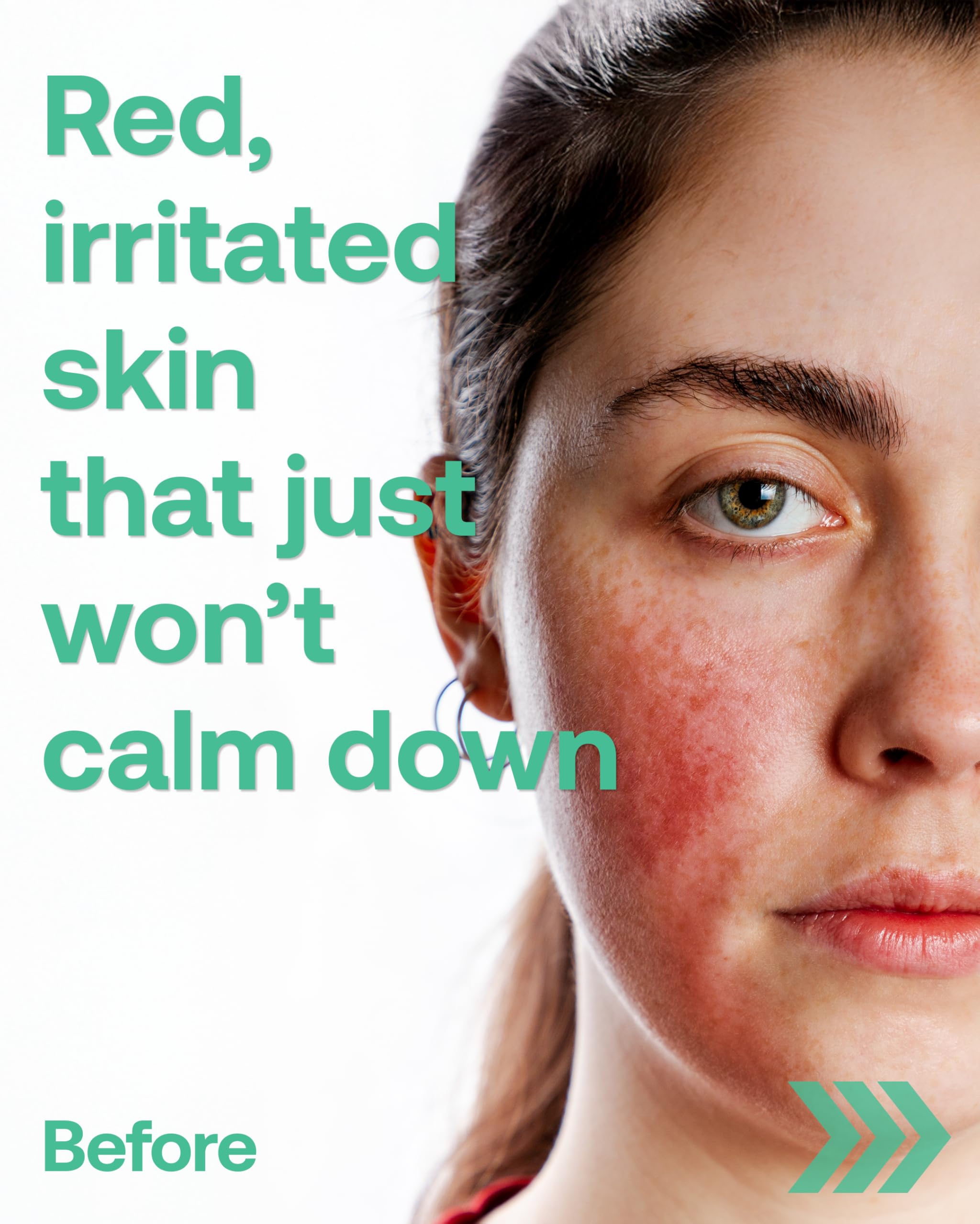 Phyto ac Infused Yulmu Trouble Serum, Korean Natural Facial - FILFLO