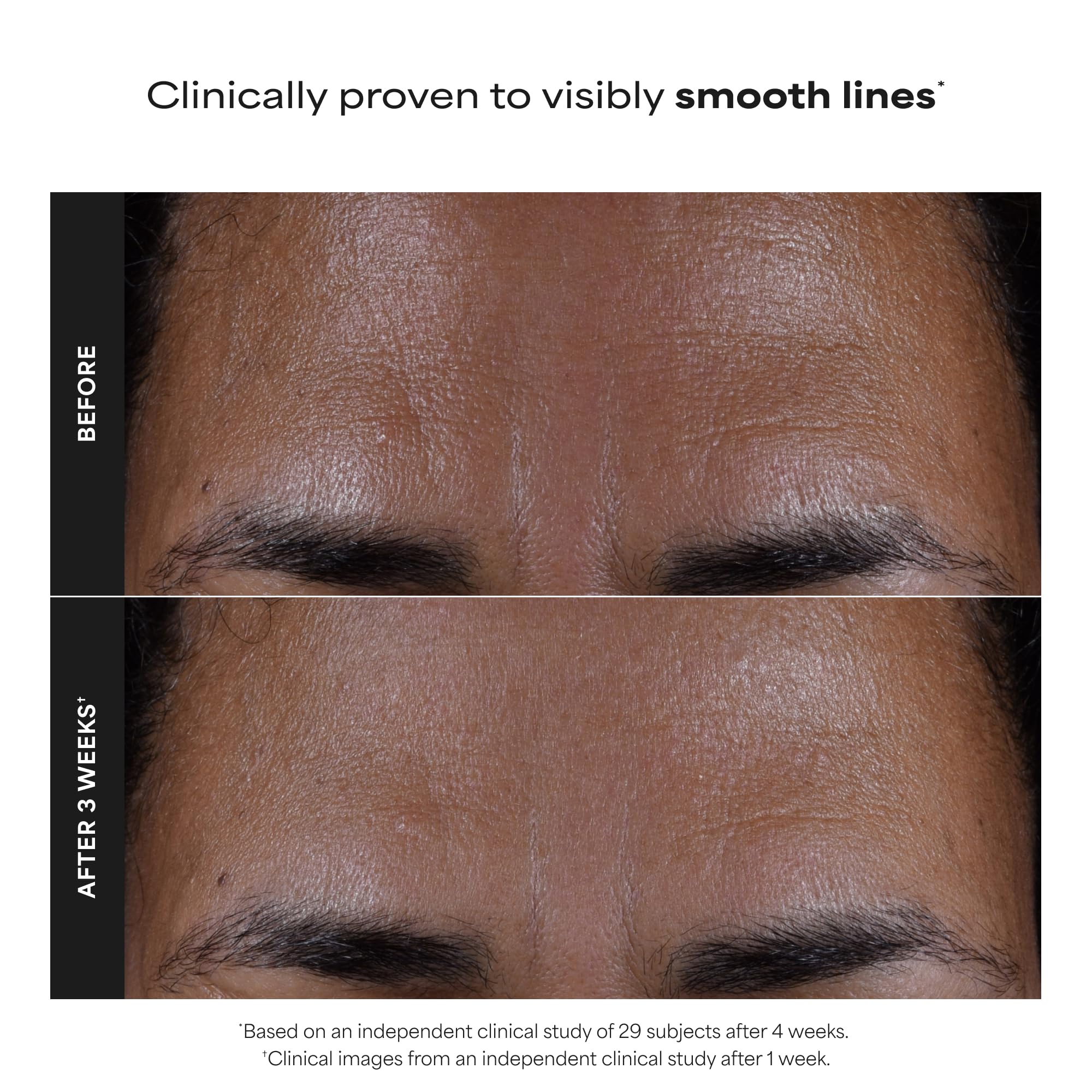 Paula's Choice SKIN PERFECTING 2% BHA Liquid Exfoliant - Elefair Tech Official Product View 5