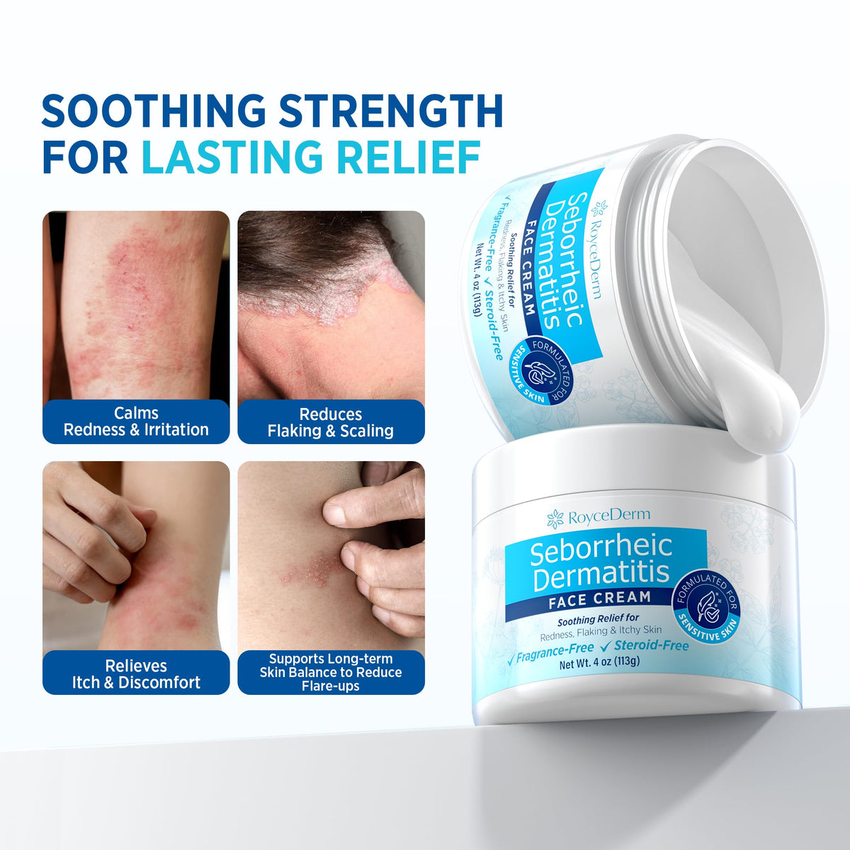 Roycederm Seborrheic Dermatitis Face Cream Steroid Free - Roycederm Official Imagery - 4