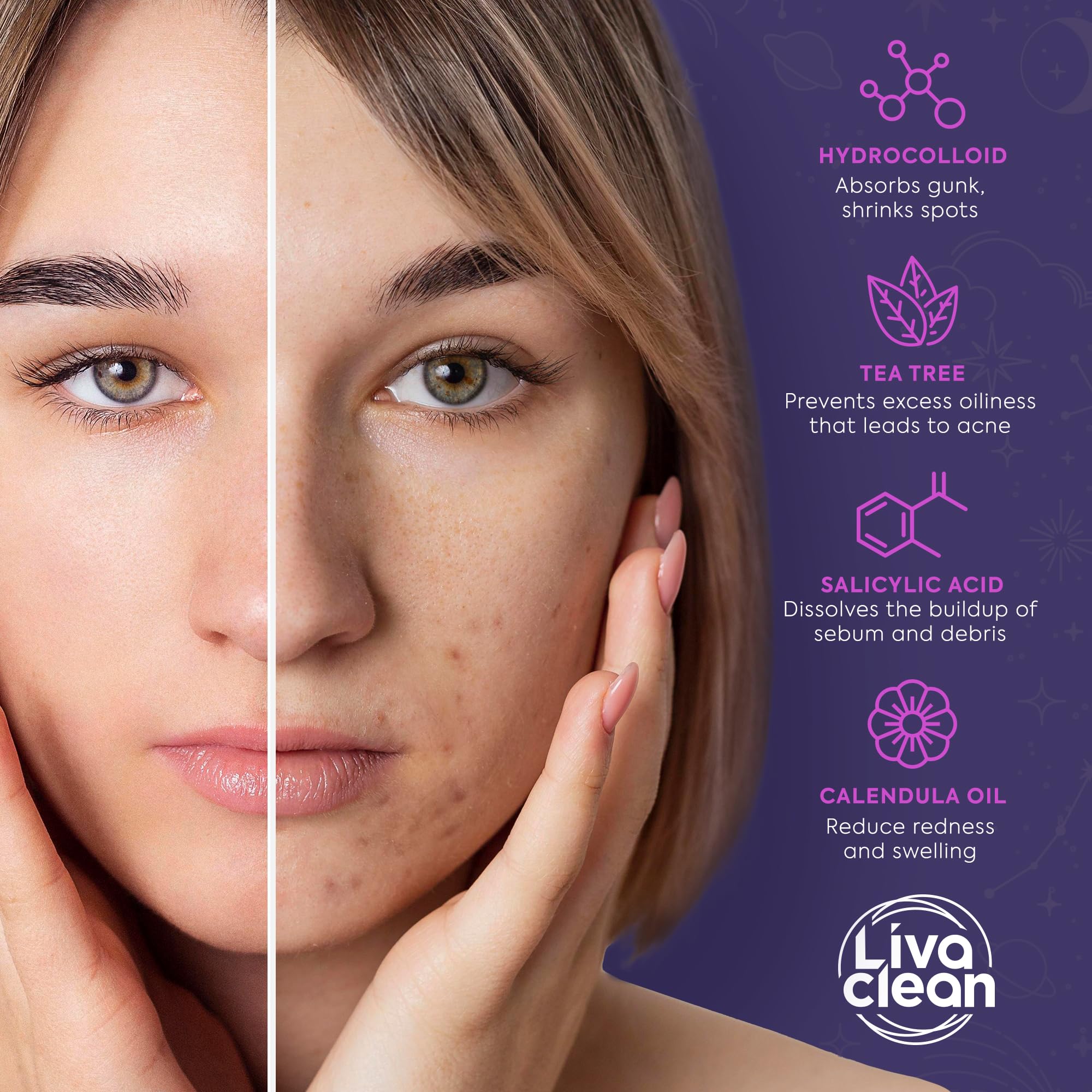 Livaclean 240 CT Star Pimple Patches for Face + 330 CT Acne - LivaClean