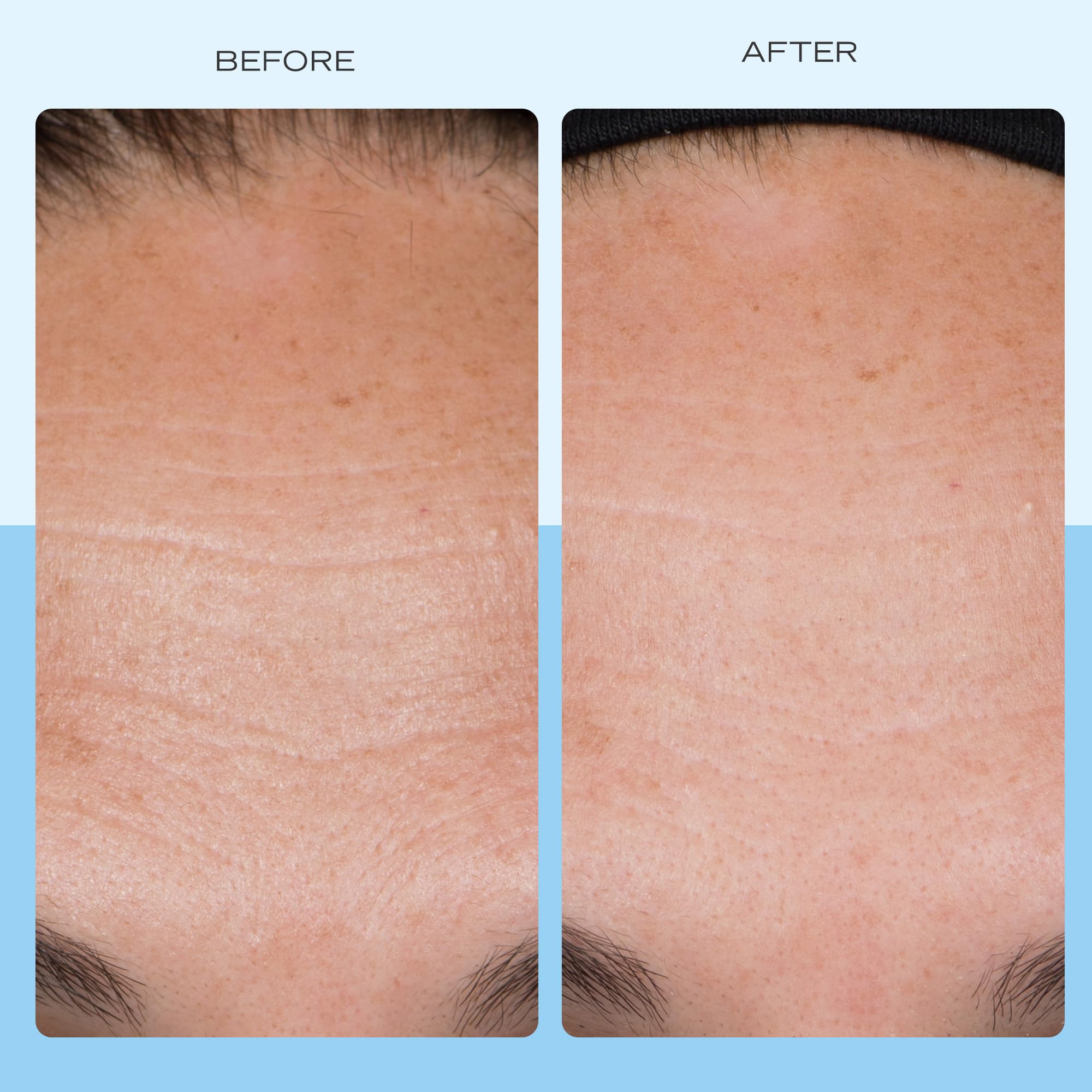 First Aid Beauty - First Aid Beauty