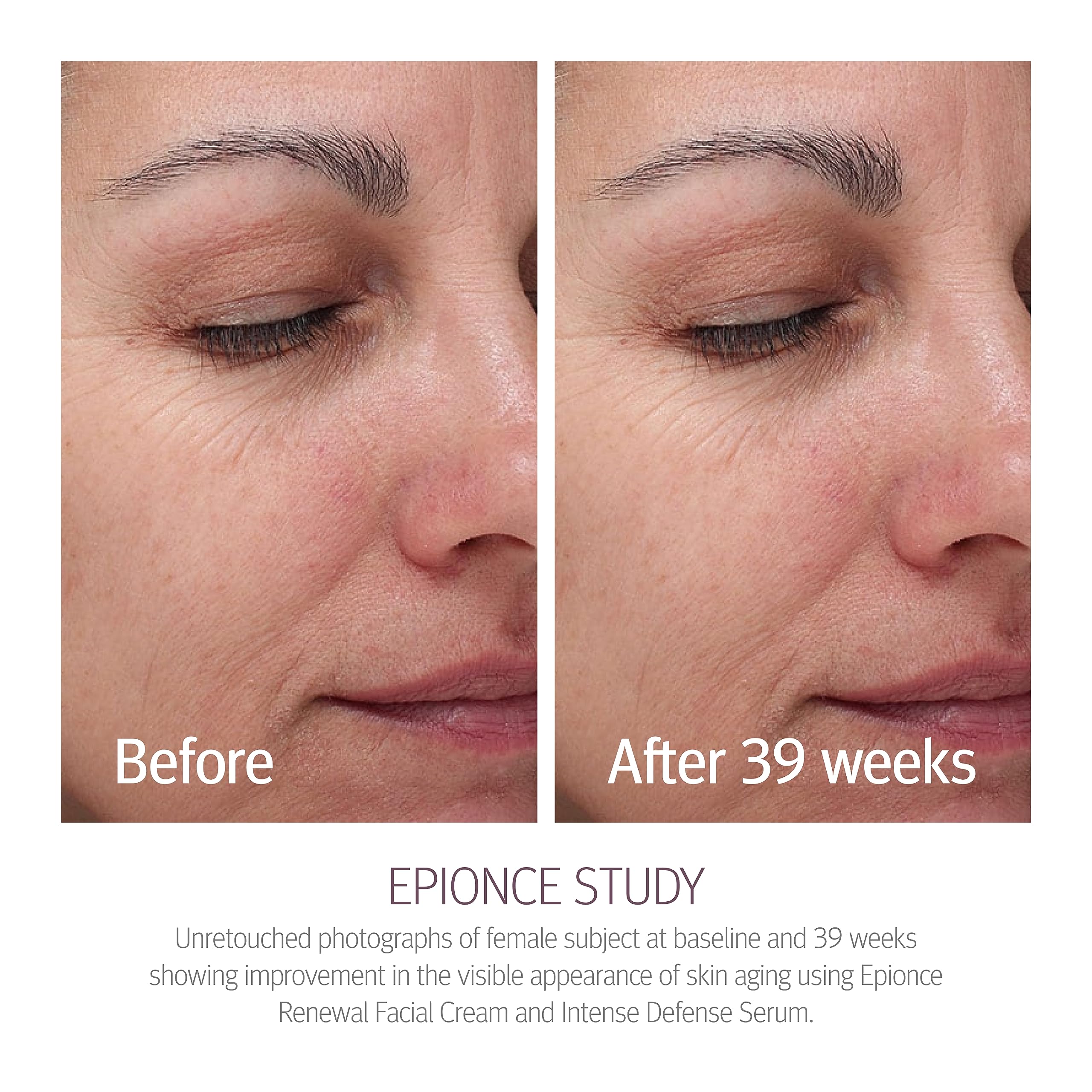 Epionce Renewal Facial Cream Hydrating Anti - Aging Skin Barrier Moisturizer - Epionce Official Product View 10