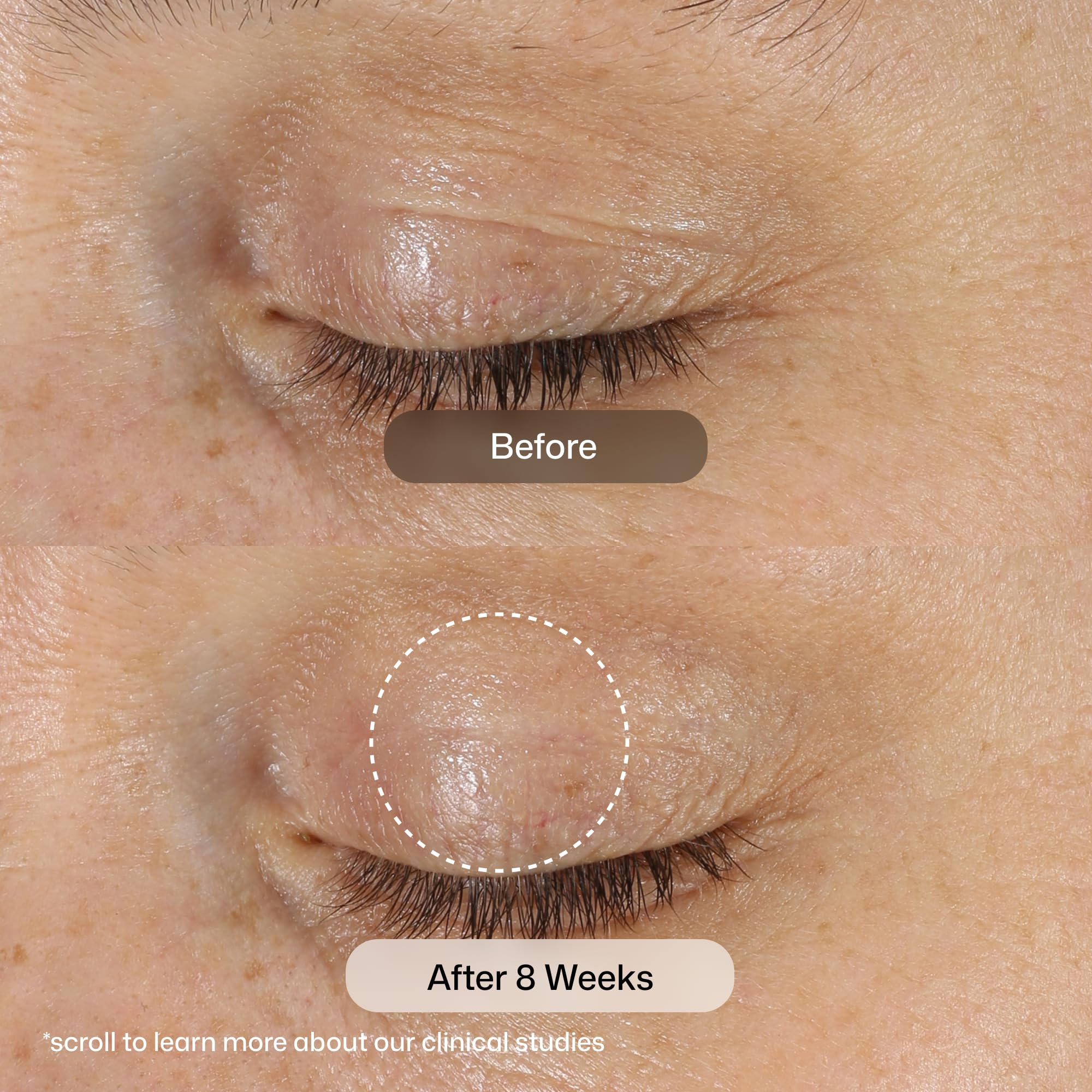 Revision Skincare D·E·J Eye Cream® Eye Cream for Fine Lines, 0 - Revision Skincare Official Product View 4