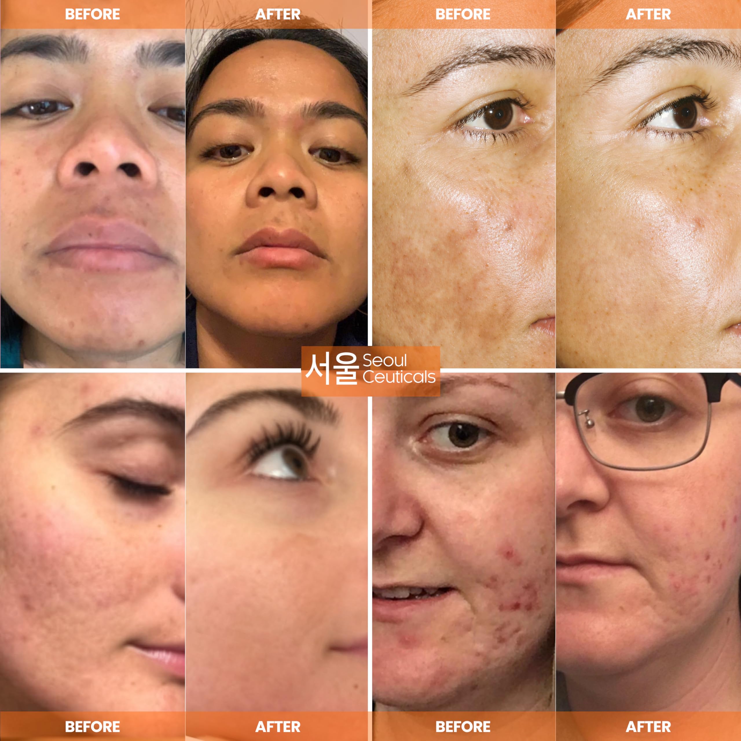 SeoulCeuticals 20% Vitamin C Serum for Face + CE Ferulic - SeoulCeuticals Official Product View 4
