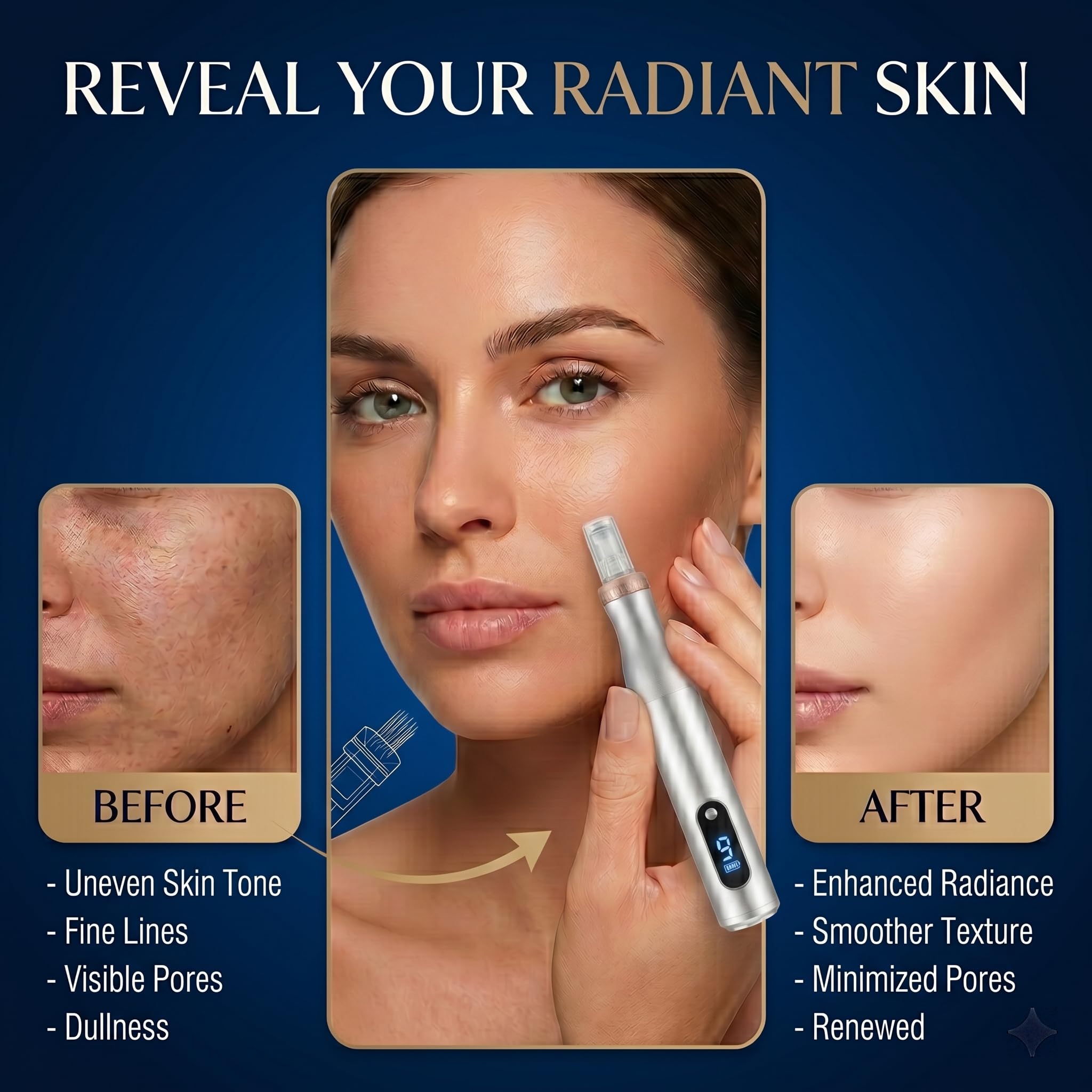 Microneedling Pen for Home Use Microneeding Derma Roller Pen - angjiar Official Imagery - 6