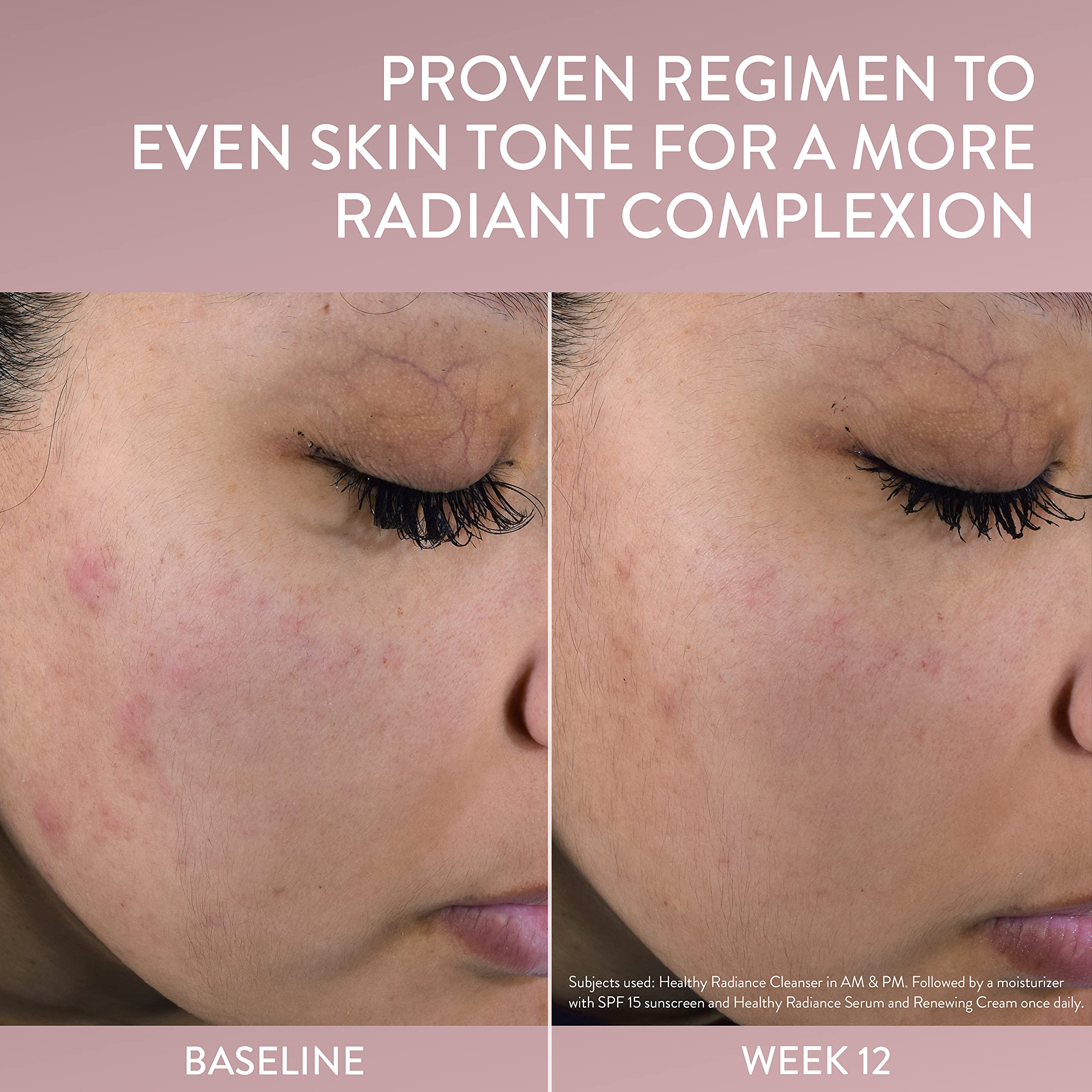 Cetaphil Healthy Radiance Dark Spot Face Serum Vitamin C 1oz - Cetaphil Official Imagery - 6