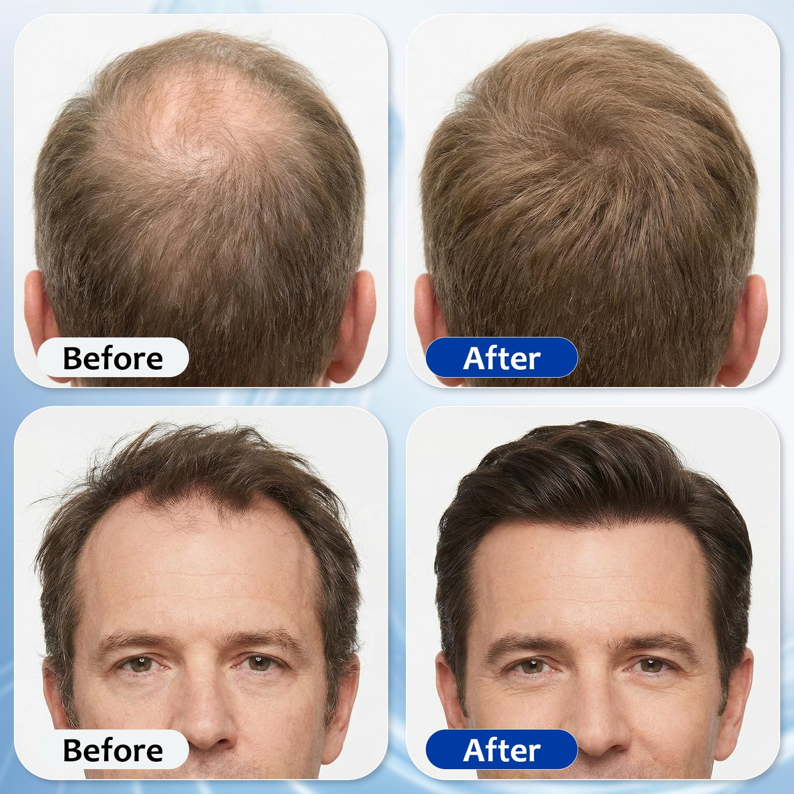 MGVAASURC Hair Growth Serum Roll On with 3% Rosemary,3% Batana Oil,2% Pea - MGVAASURC Official Product View 6