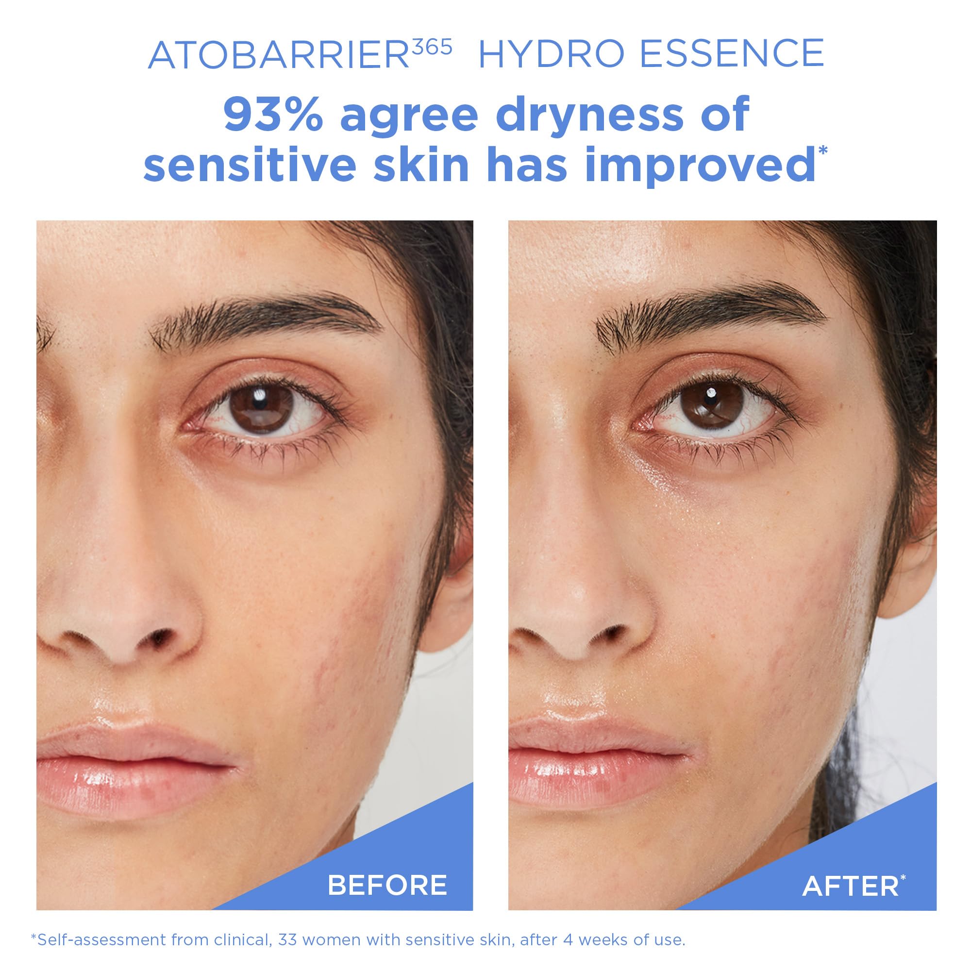 AESTURA ATOBARRIER365 Hydro Essence with Hydrating Amino Acids - AESTURA