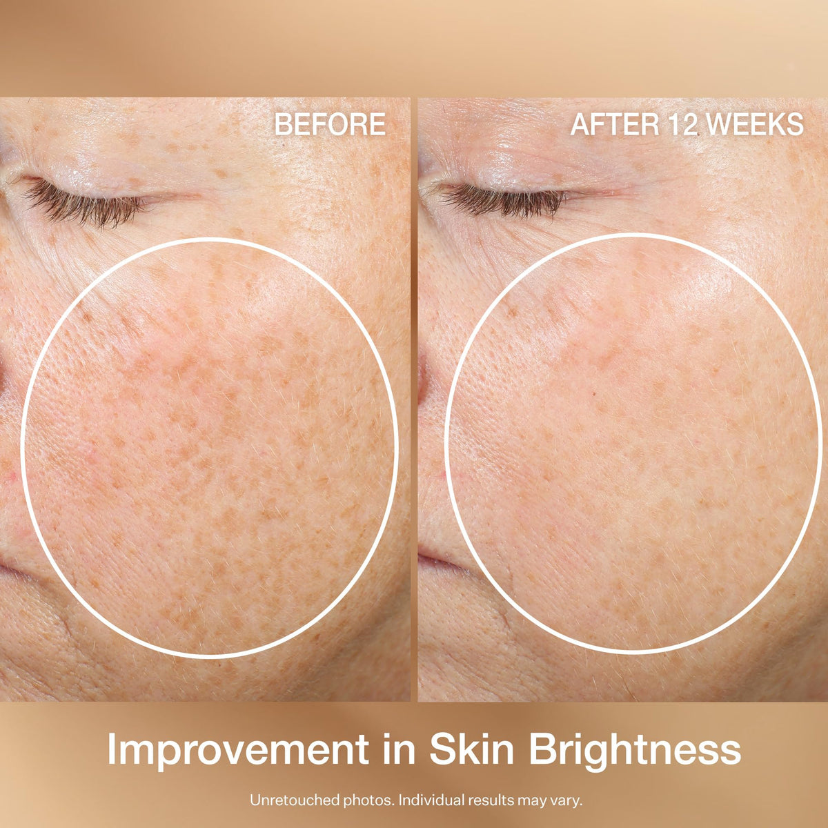 StriVectin Super C Retinol Brighten Correct Vitamin C Serum - Premium Selection Official Imagery - 6