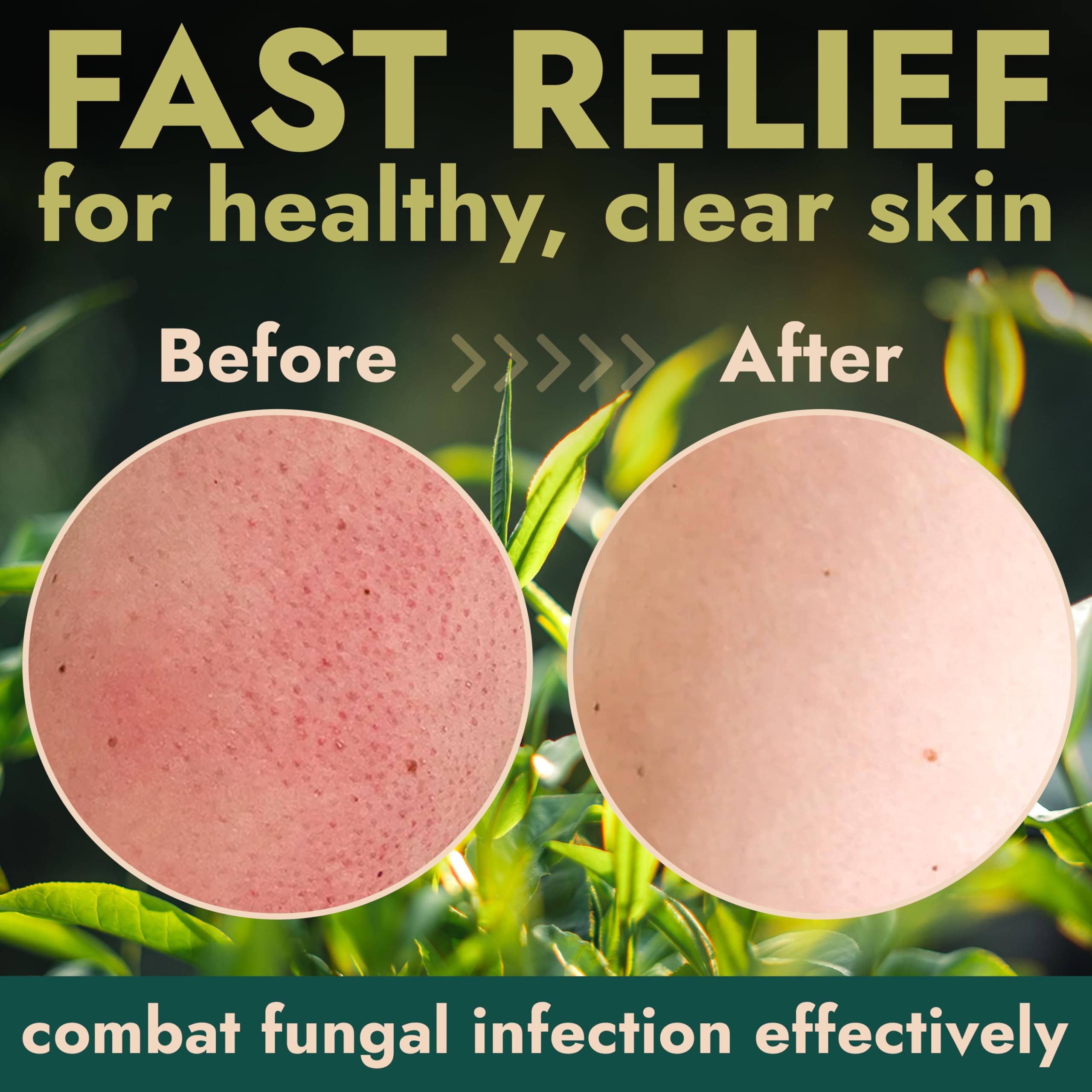 Terramed Antifungal Body Scrub with Tea Tree Oil 4-in-1