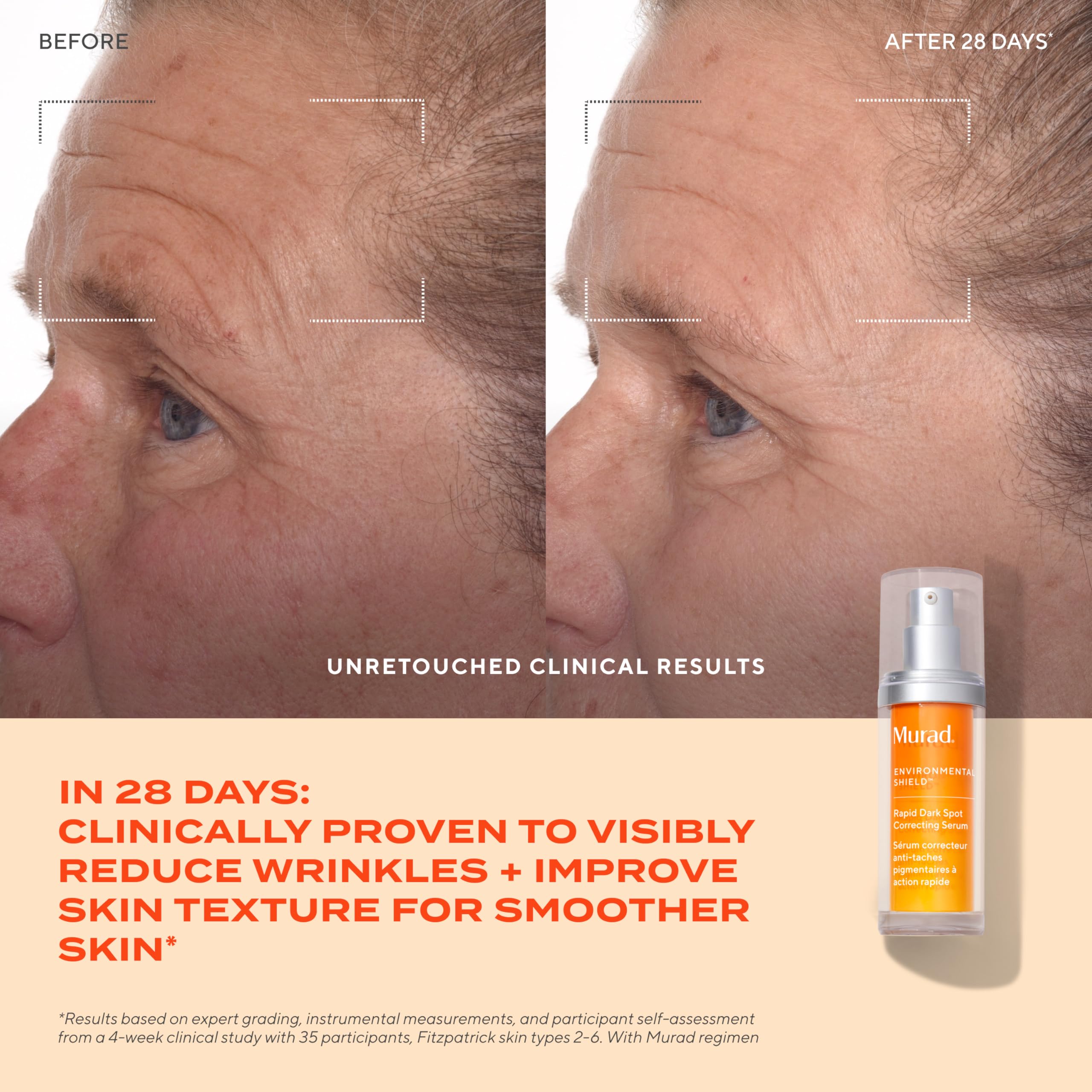 Murad Rapid Dark Spot Correcting Serum 1 oz