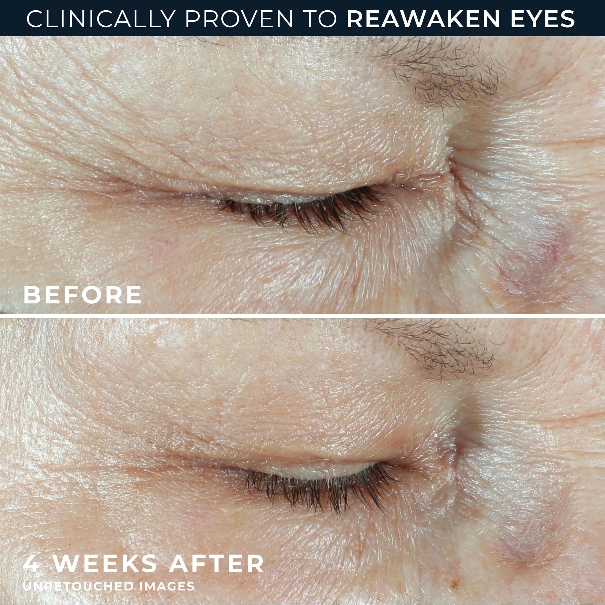 RoC Hyaluronic Acid Anti Aging Under Eye Cream 0 5oz Retinol - RoC Official Imagery - 6