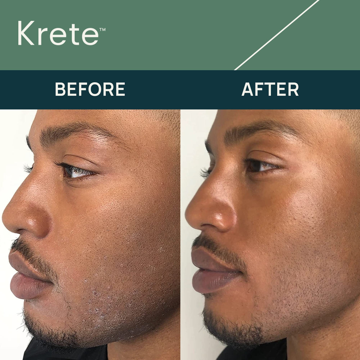 KRETE 30 Seconds Hydrating Facial Serum for Men - krete Official Imagery - 4