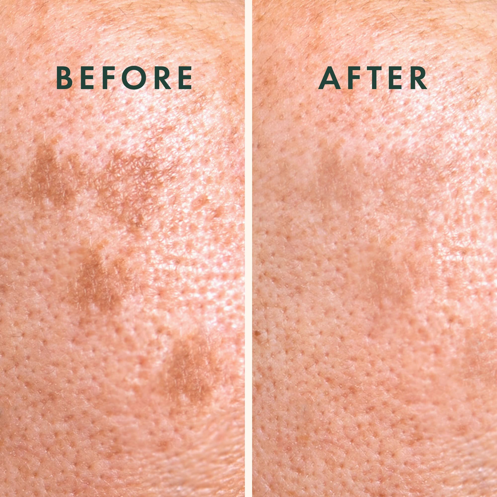 Rael Miracle Microcrystal Vitamin C Dark Spot Cover Pimple - Rael Official Product Imagery - 6
