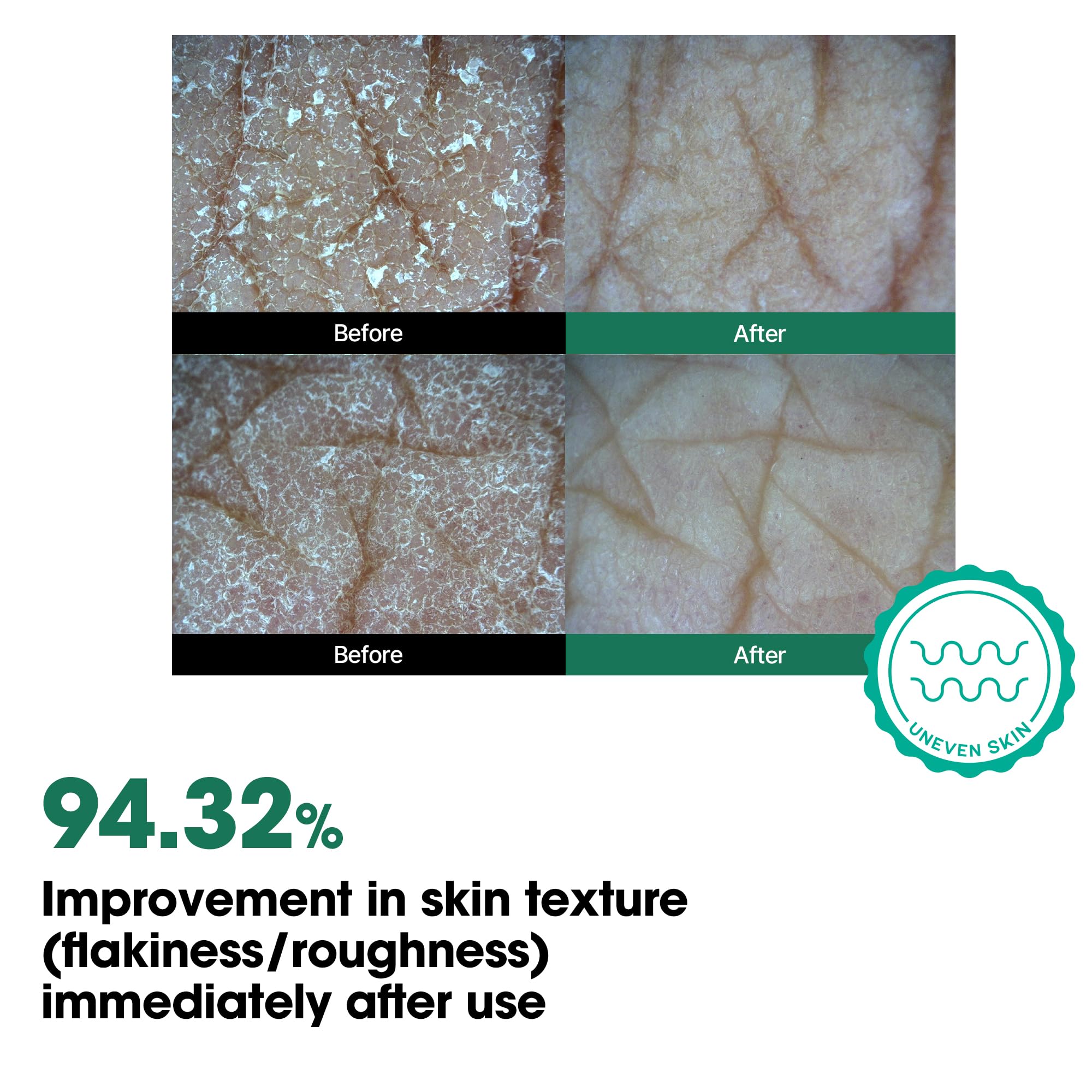 SOME BY MI AHA BHA PHA 30 Days Miracle Body Toner Mist – 4. , – Body Spray for - SOME BY MI Official Product View 6