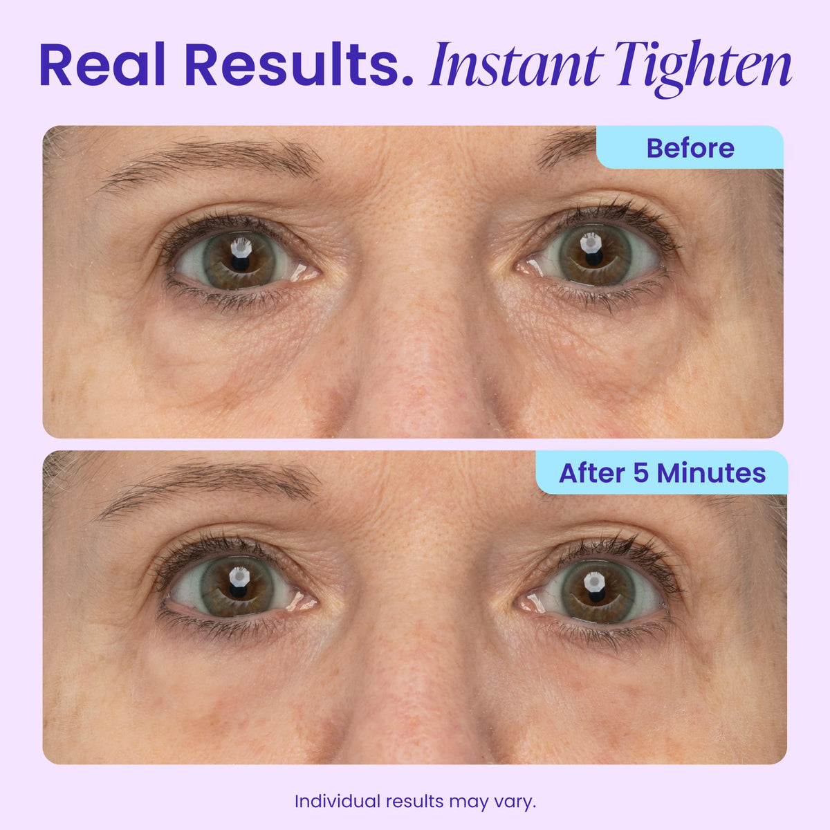 goPure NEW Instant Lift Eye Gel - goPure Official Imagery - 4