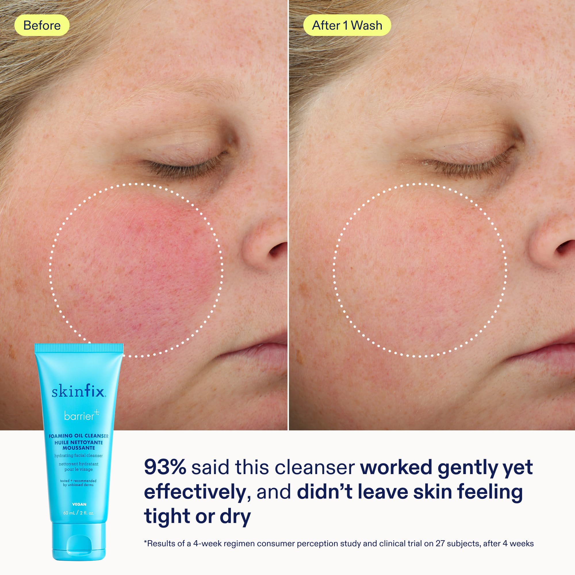 Skinfix Barrier Better Skin Starts Here Kit - Skinfix Official Imagery - 4