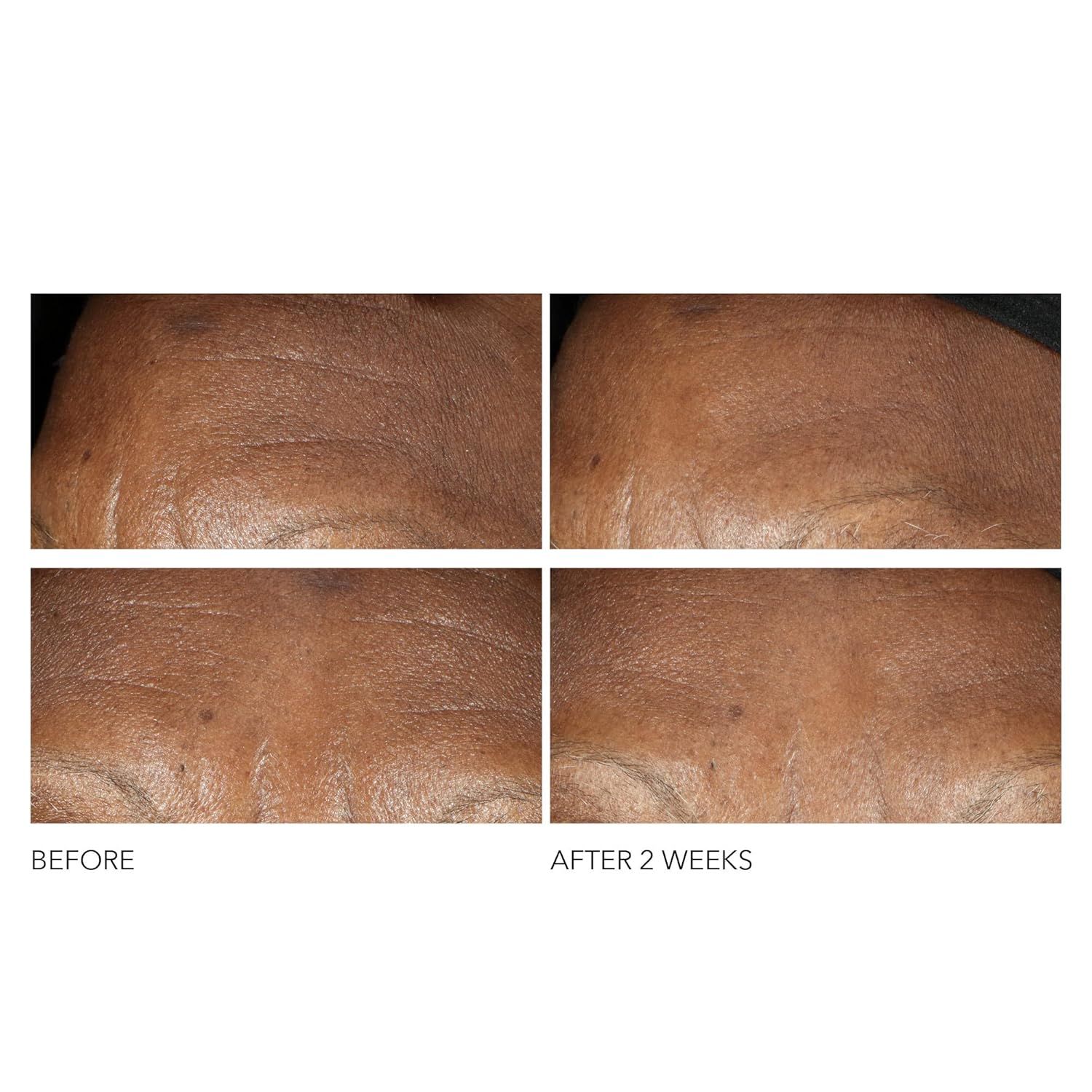 Dr Dennis Gross Advanced Retinol + Ferulic Wrinkle Cream jar showing its label and creamy texture for intense hydration and anti-aging.