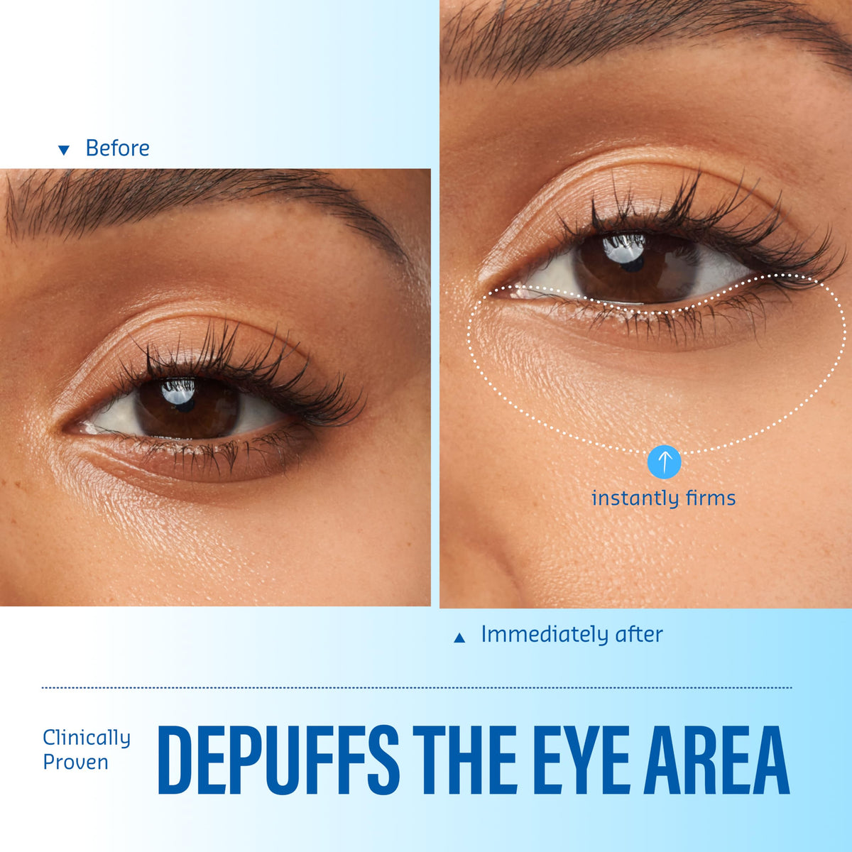 belif Aqua Bomb Cooling Eye Gel - belif Official Imagery - 5