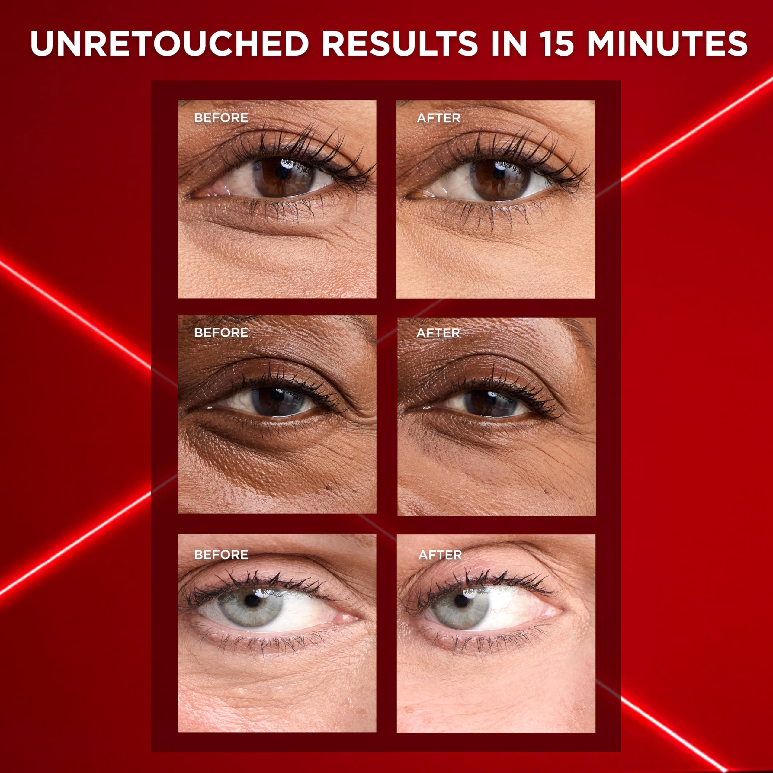 Elefair Tech L'Oreal Paris Revitalift Triple Power Eye Bag Instant Eraser, Eye - Elefair Tech Official Product View 4