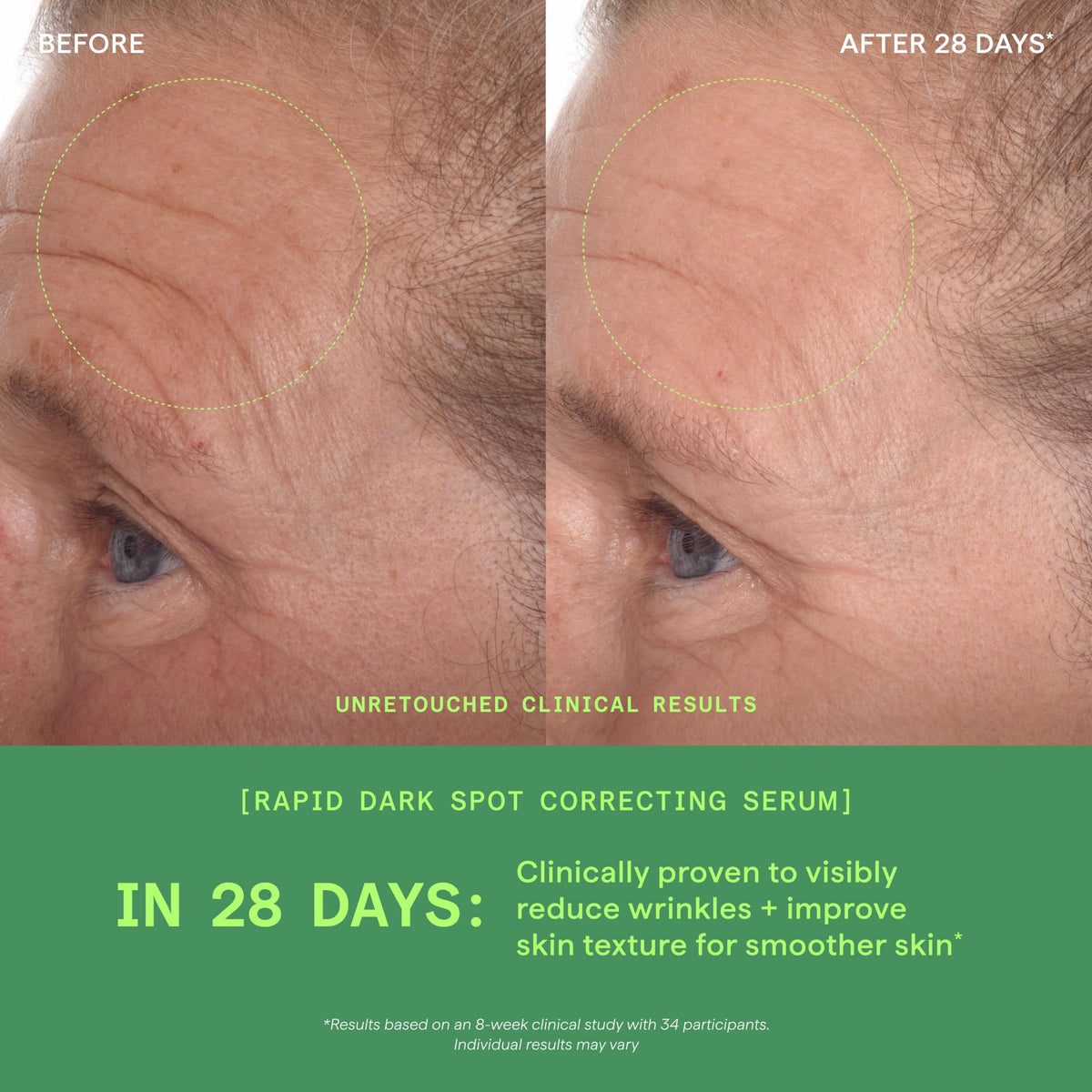 Murad Rapid Dark Spot Correcting Serum - Premium Selection Official Imagery - 6