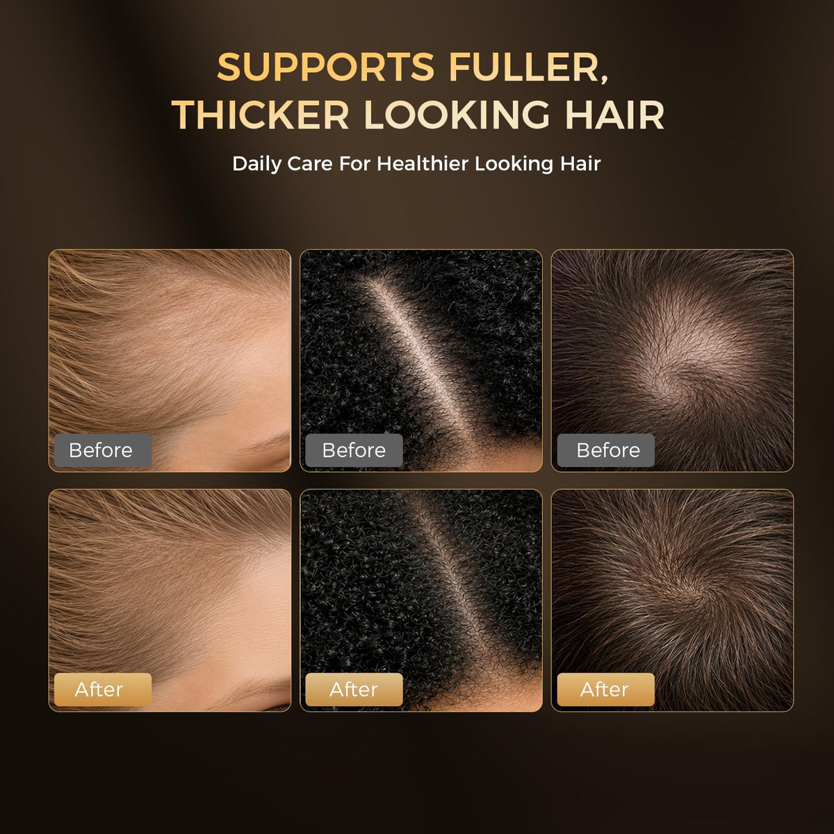 Hair Growth Serum Spray for Women and Men Thinning Hair 2 0 - BIYSBER Official Imagery - 4