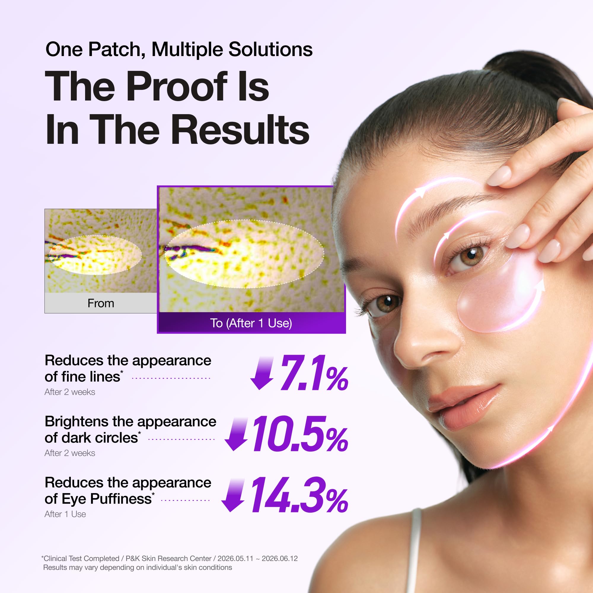 ANUA Retinol Berry Eye Patches - ANUA Official Product View 4