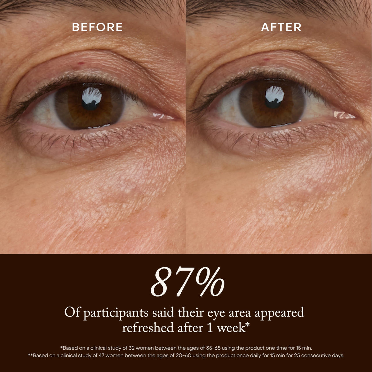 True Botanicals Chebula Multi Corrective Eye Patches - True Botanicals Official Imagery - 6