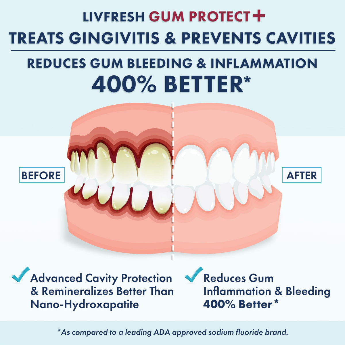 LIVFRESH Gum Protect Toothpaste Gel Gingivitis Treatment - LIVFRESH Official Imagery - 3