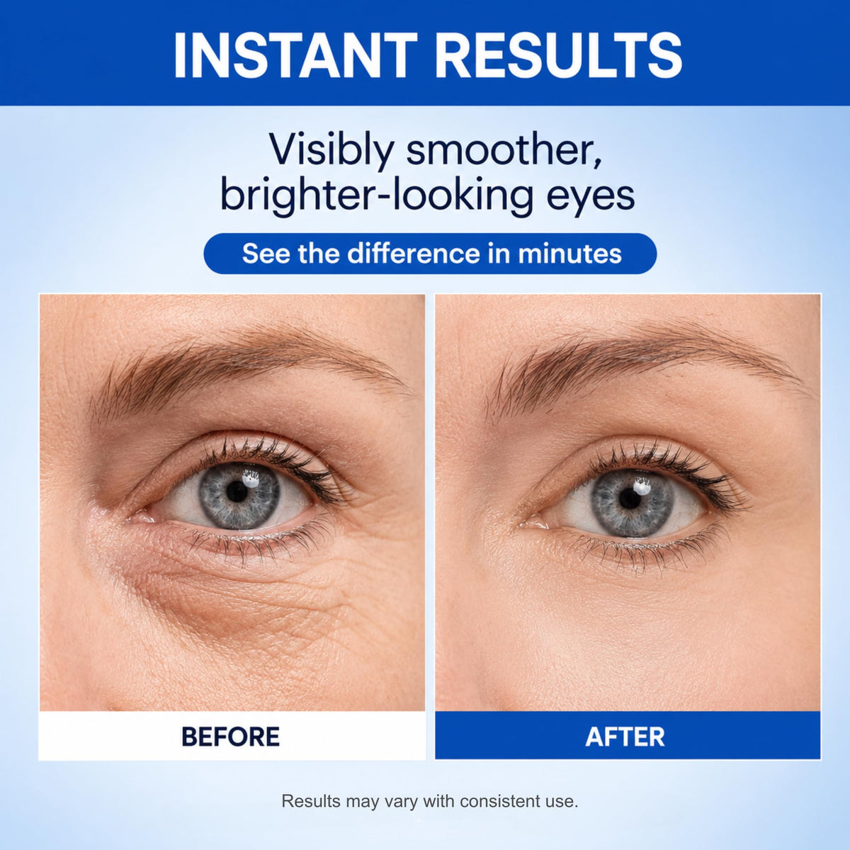 Instant Under Eye Serum for Bags Wrinkles Dark Circles 20mL - PLEXFIRM Official Imagery - 3
