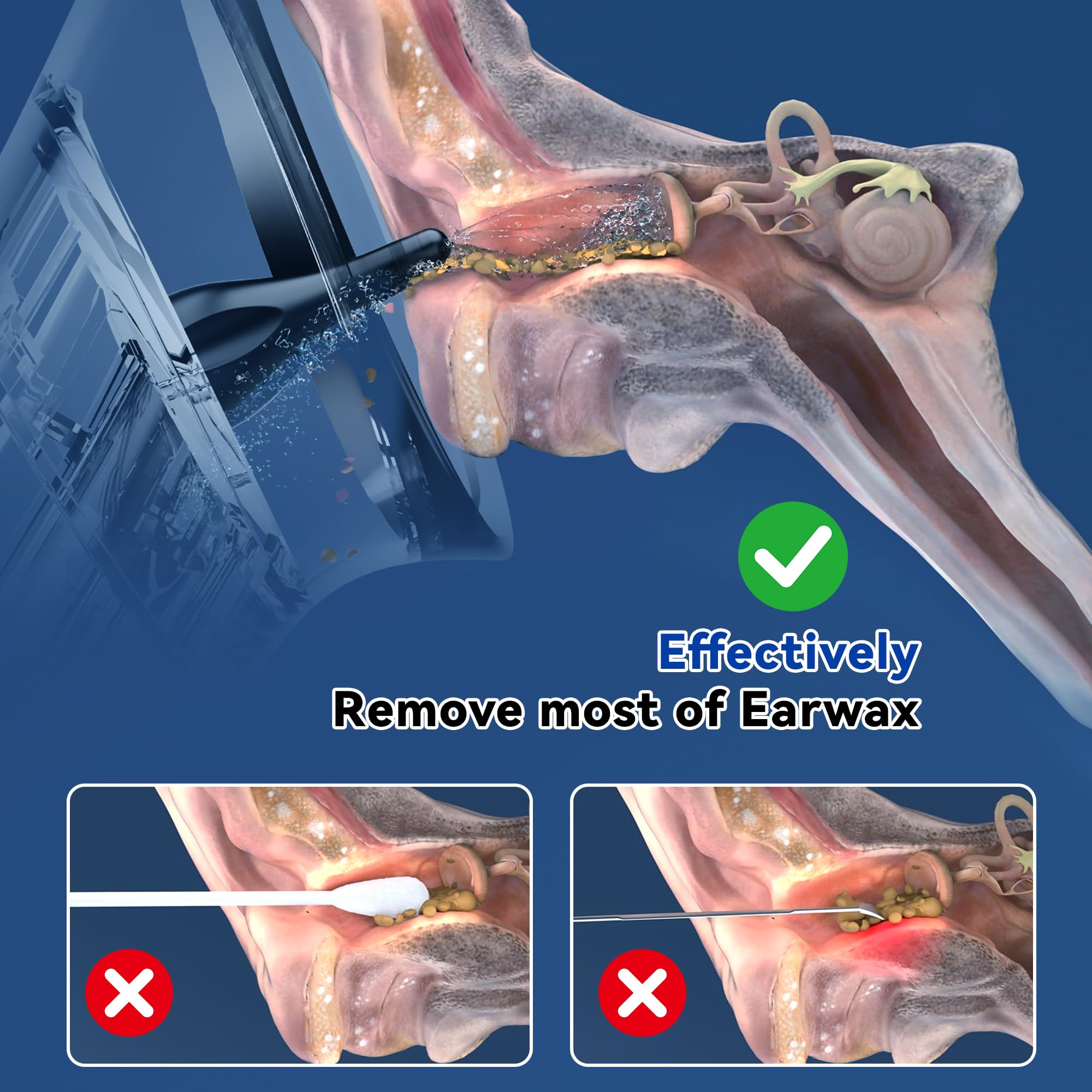 ENERKIDI Upgraded Electric Ear Wax Removal Kit - Water Temperature Sen - View 7