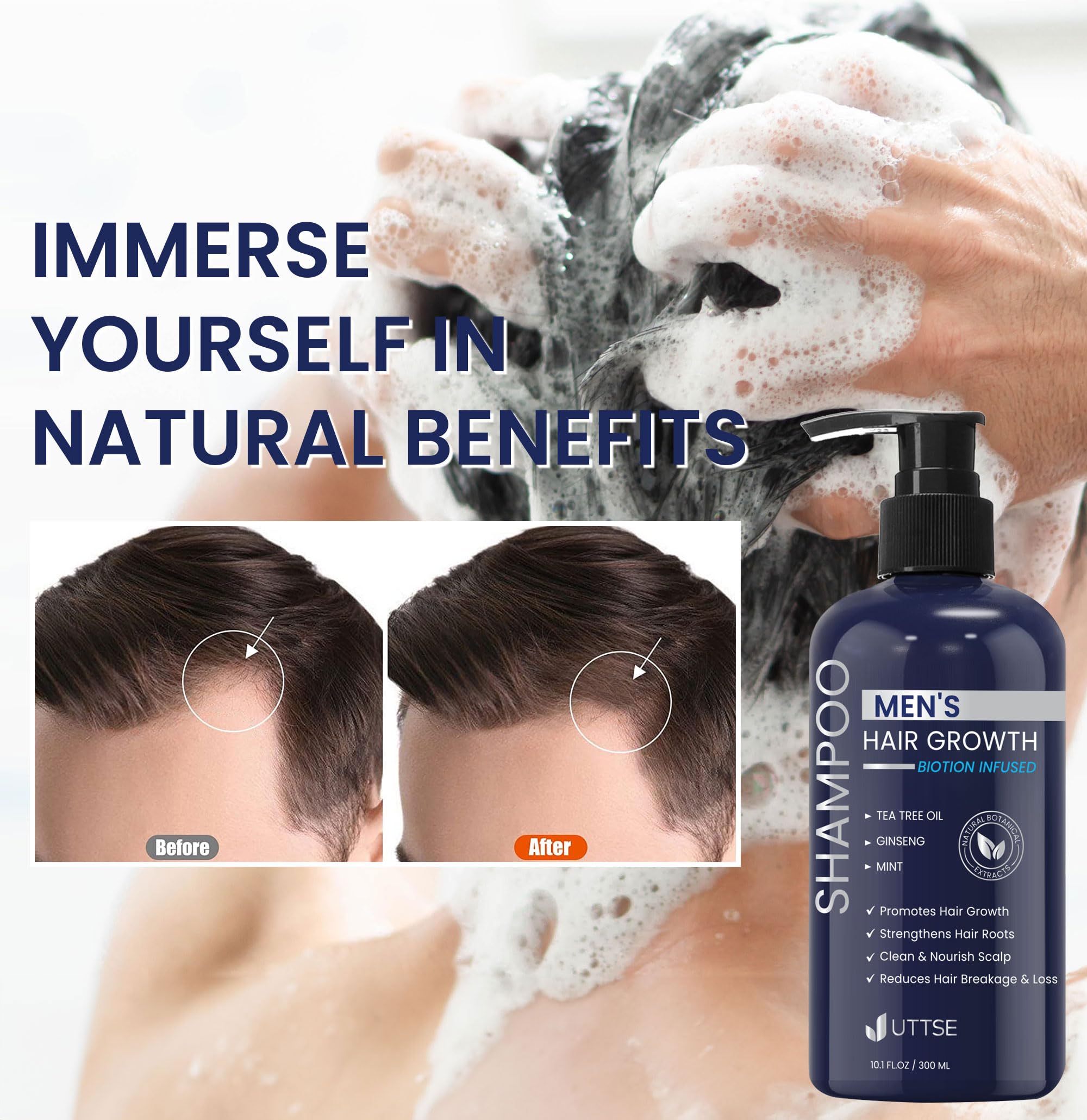 Uttse Biotin Hair Growth Shampoo for Men Natural Thickening - Uttse Official Imagery - 7