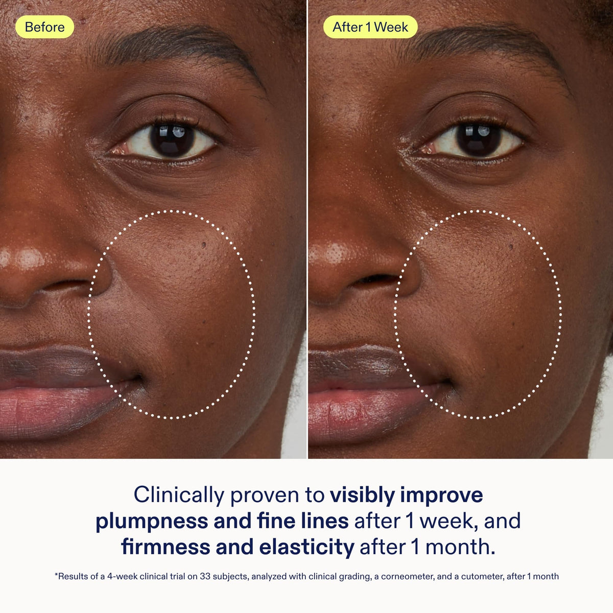 Skinfix Triple Lipid Activating Serum - Skinfix Official Imagery - 4