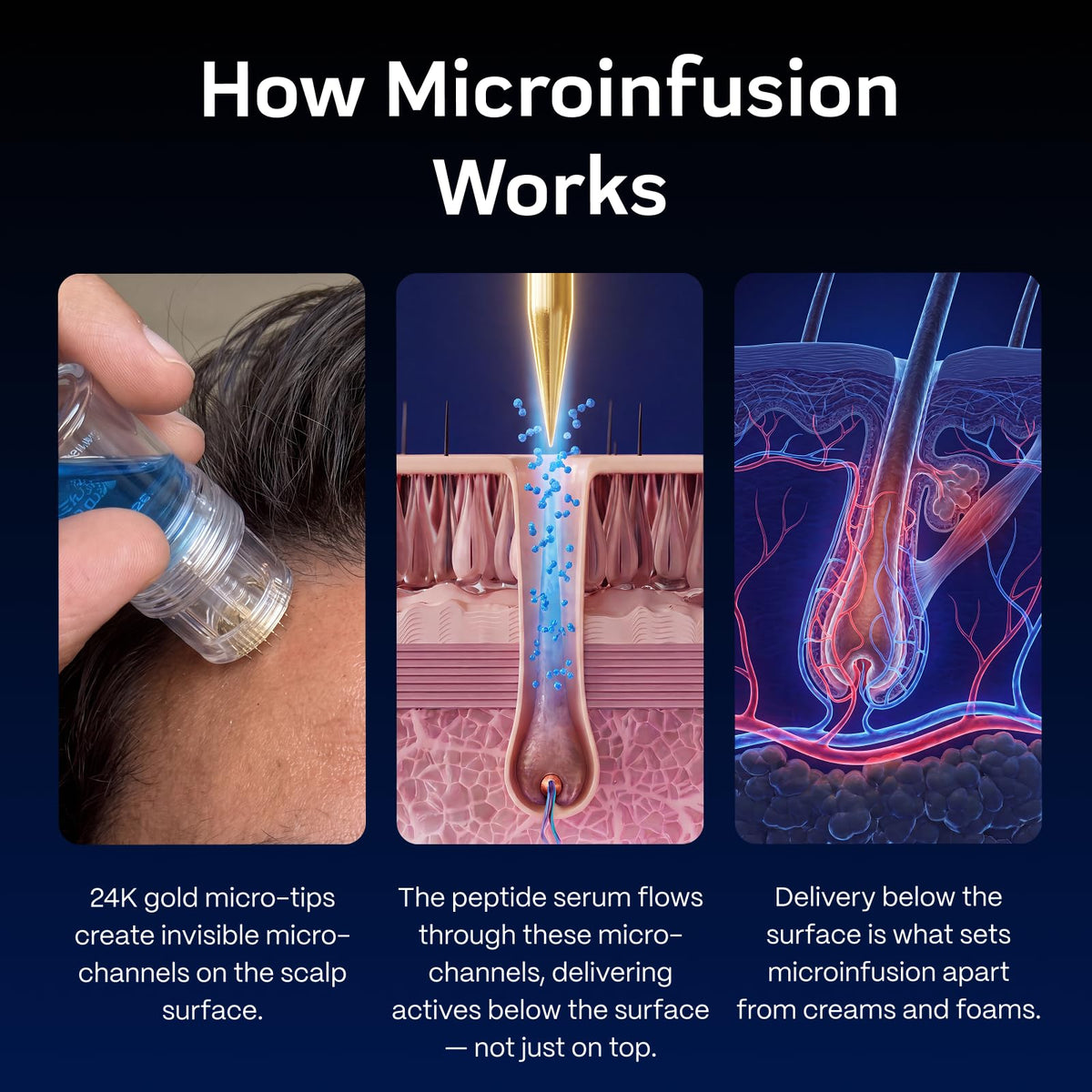 BlueForce Follifusion Hair Microinfusion System With Copper - Blueforce Official Imagery - 8